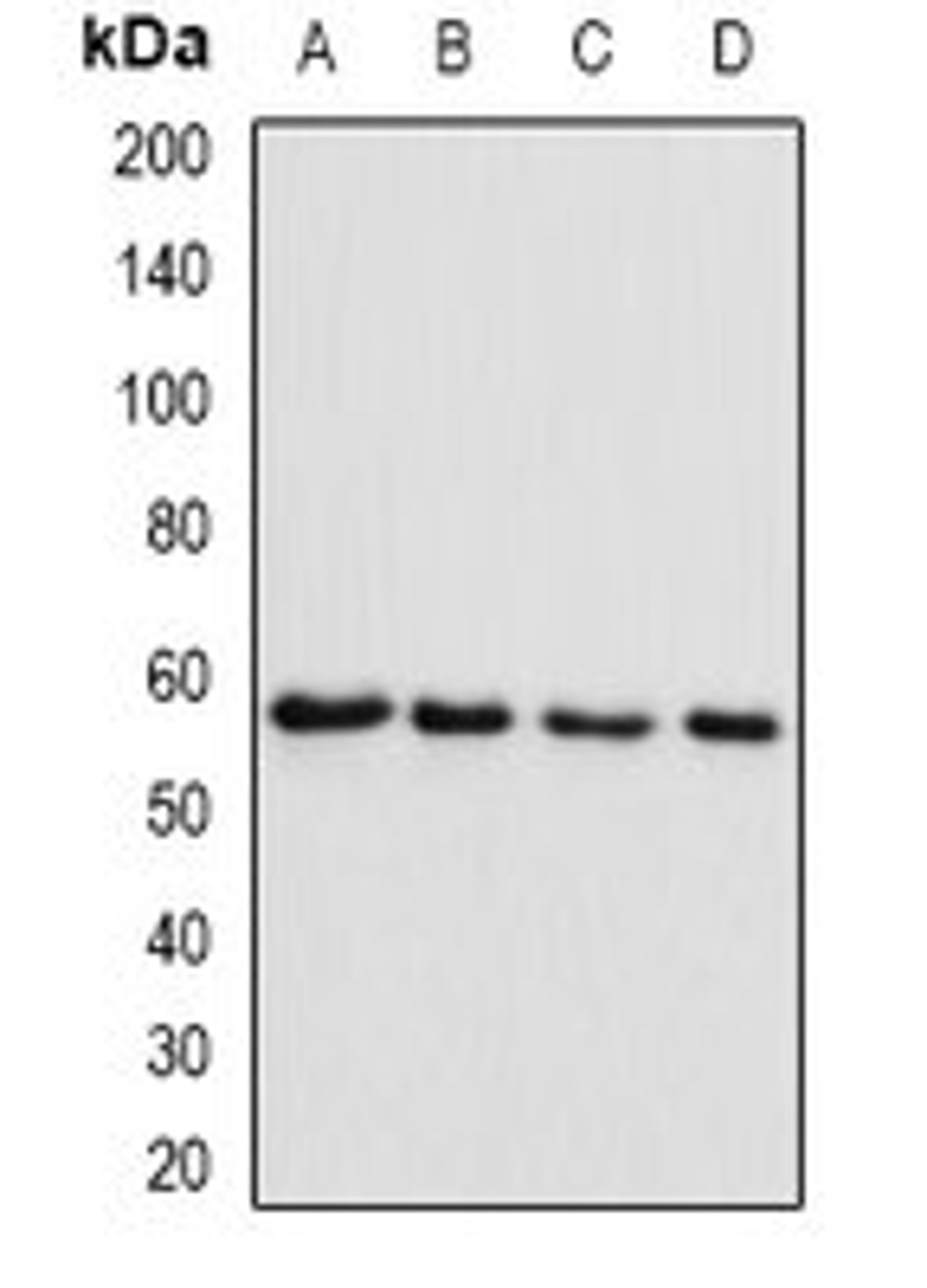 Western blot analysis of Raji (Lane1), MCF7 (Lane2), mouse skeletal muscle (Lane3), rat heart (Lane4) whole cell lysates using SMYD1 antibody