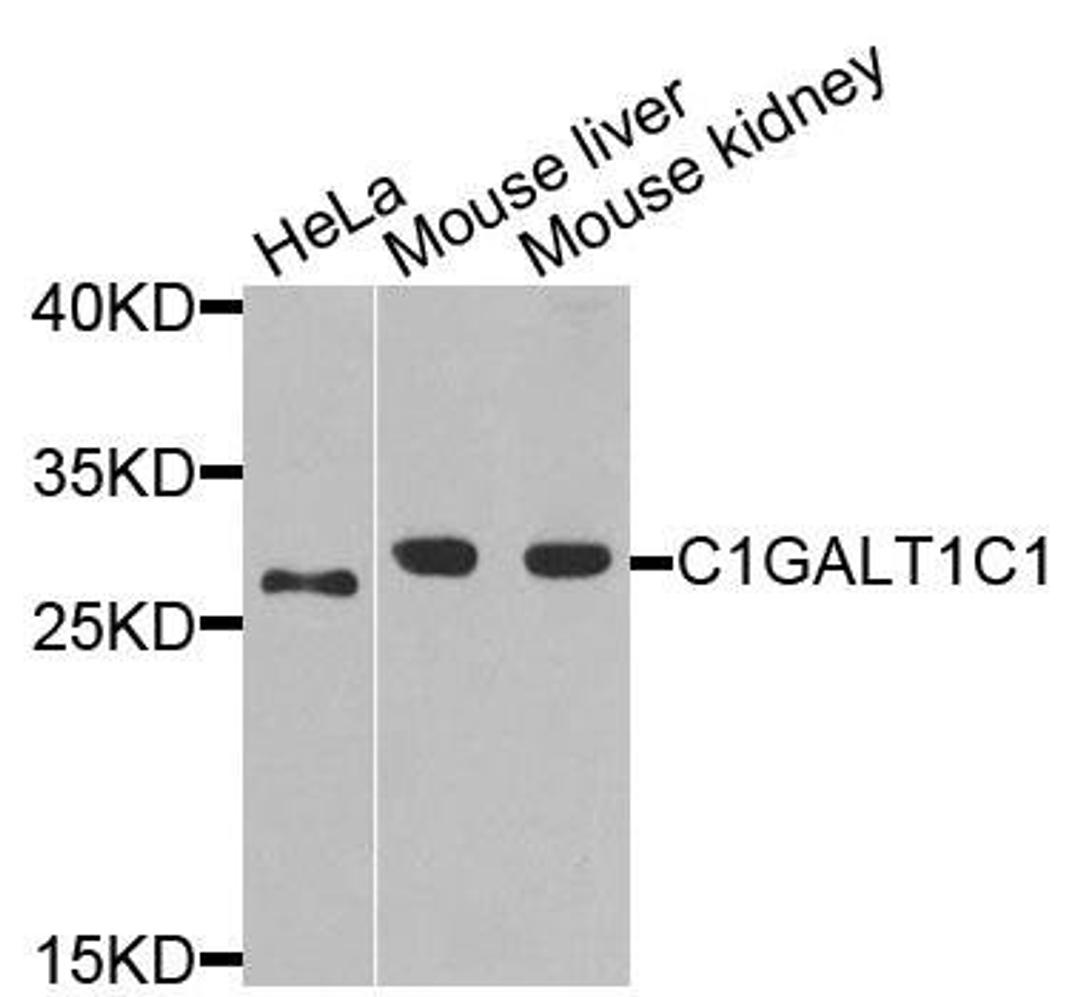 Western blot analysis of extracts of various cells using C1GALT1C1 antibody