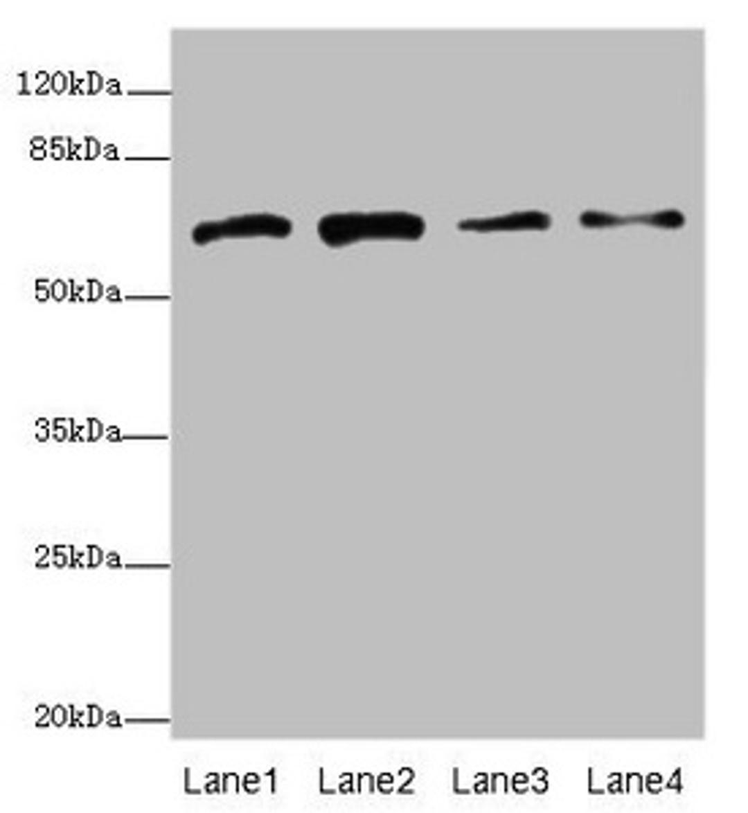 Western blot. All lanes: GALNT2 antibody at 4.38µg/ml. Lane 1: Hela whole cell lysate. Lane 2: Jurkat whole cell lysate. Lane 3: HepG2 whole cell lysate. Lane 4: A431 whole cell lysate. Secondary. Goat polyclonal to rabbit IgG at 1/10000 dilution. Predicted band size: 65, 31 kDa. Observed band size: 65 kDa