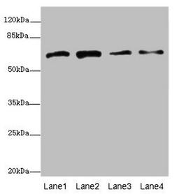 Western blot. All lanes: GALNT2 antibody at 4.38µg/ml. Lane 1: Hela whole cell lysate. Lane 2: Jurkat whole cell lysate. Lane 3: HepG2 whole cell lysate. Lane 4: A431 whole cell lysate. Secondary. Goat polyclonal to rabbit IgG at 1/10000 dilution. Predicted band size: 65, 31 kDa. Observed band size: 65 kDa