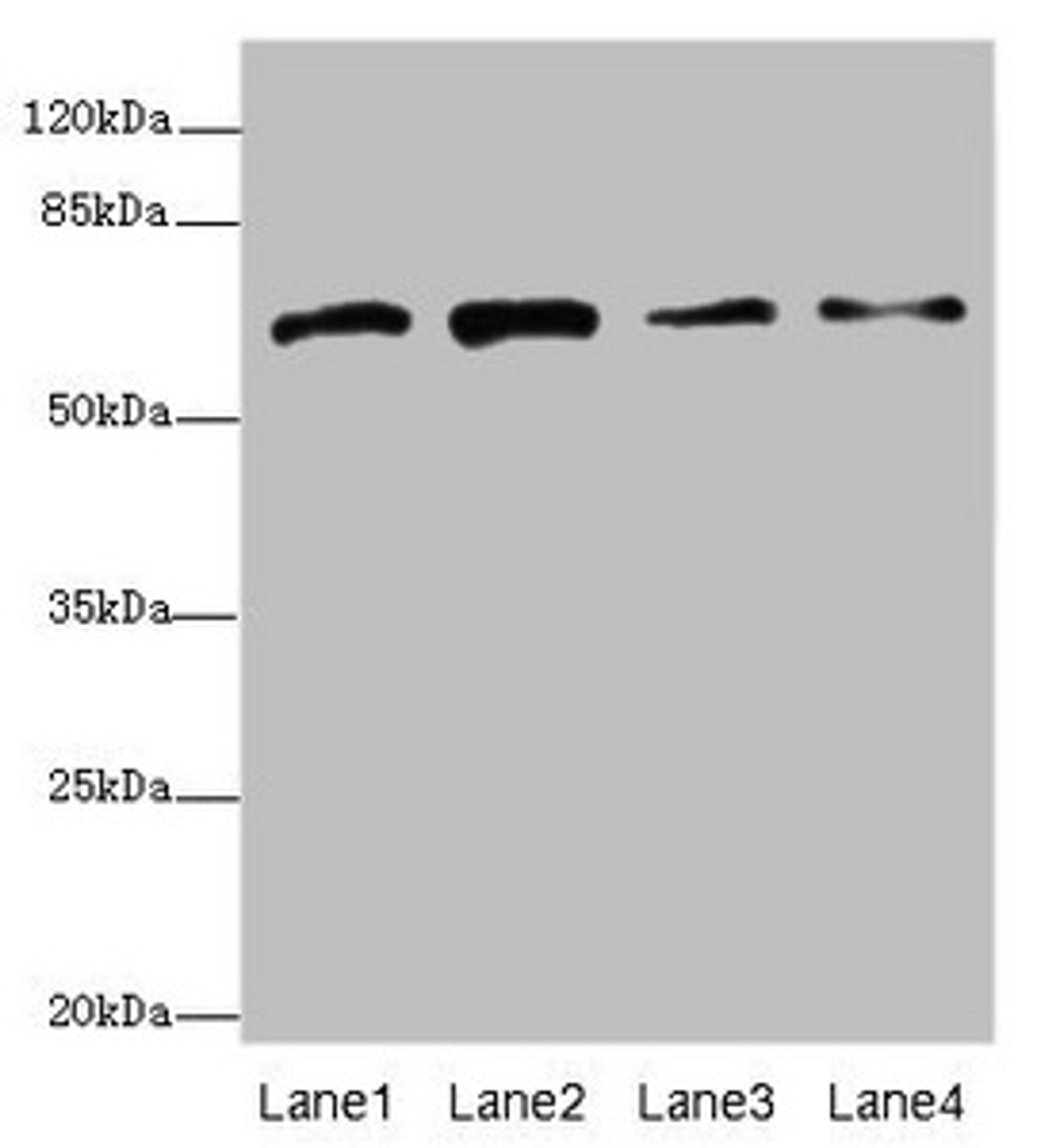 Western blot. All lanes: GALNT2 antibody at 4.38µg/ml. Lane 1: Hela whole cell lysate. Lane 2: Jurkat whole cell lysate. Lane 3: HepG2 whole cell lysate. Lane 4: A431 whole cell lysate. Secondary. Goat polyclonal to rabbit IgG at 1/10000 dilution. Predicted band size: 65, 31 kDa. Observed band size: 65 kDa