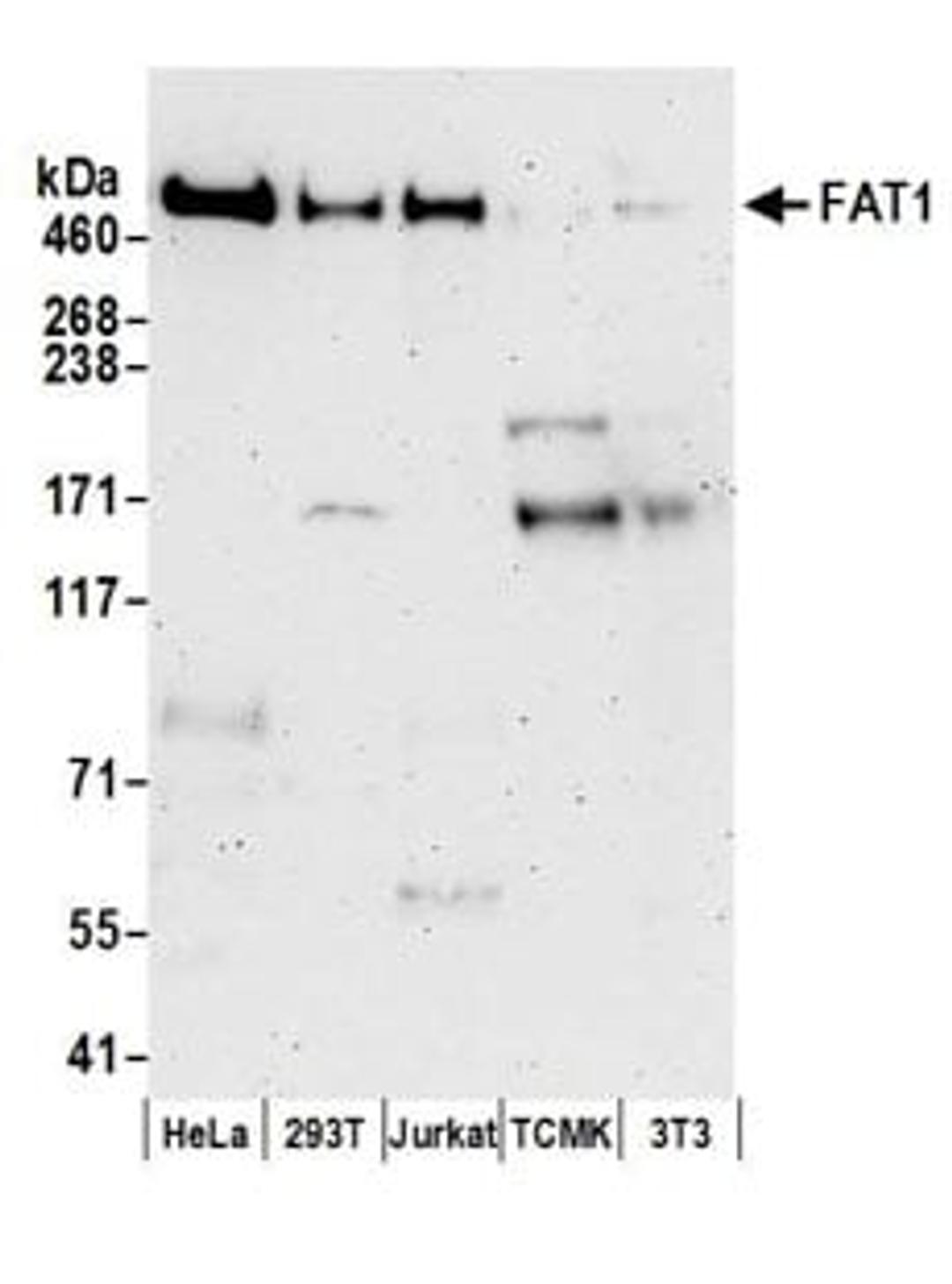 Detection of human FAT1 by western blot.