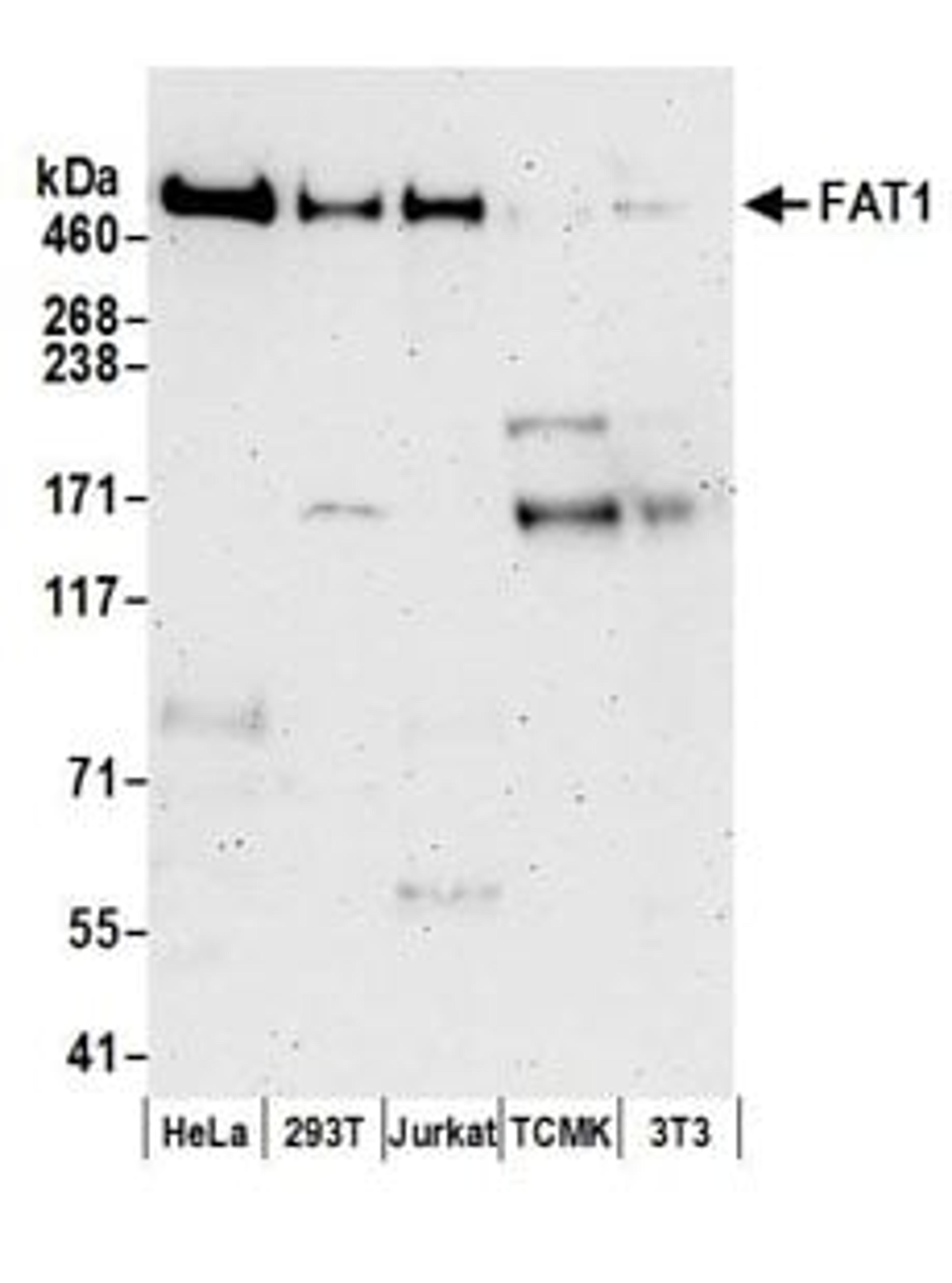 Detection of human FAT1 by western blot.