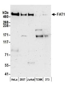 Detection of human FAT1 by western blot.