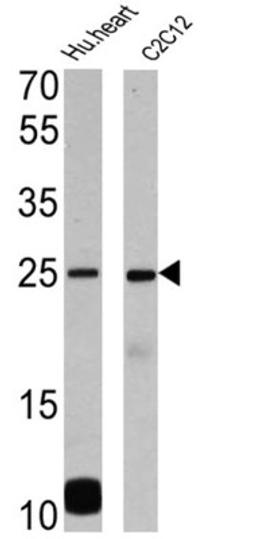 Western Blot: Phospholamban Antibody (2D12) [NB300-582] - Analysis of 25 ug of human heart (lane 1) and C2C12 (lane 2).