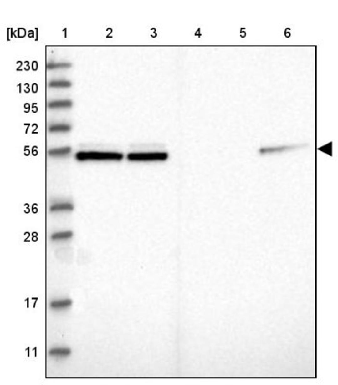 Western Blot: NAP1L1 Antibody [NBP1-81162] - Lane 1: Marker [kDa] 230, 130, 95, 72, 56, 36, 28, 17, 11<br/>Lane 2: Human cell line RT-4<br/>Lane 3: Human cell line U-251MG sp<br/>Lane 4: Human plasma (IgG/HSA depleted)<br/>Lane 5: Human liver tissue<br/>Lane 6: Human tonsil tissue