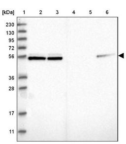 Western Blot: NAP1L1 Antibody [NBP1-81162] - Lane 1: Marker [kDa] 230, 130, 95, 72, 56, 36, 28, 17, 11<br/>Lane 2: Human cell line RT-4<br/>Lane 3: Human cell line U-251MG sp<br/>Lane 4: Human plasma (IgG/HSA depleted)<br/>Lane 5: Human liver tissue<br/>Lane 6: Human tonsil tissue