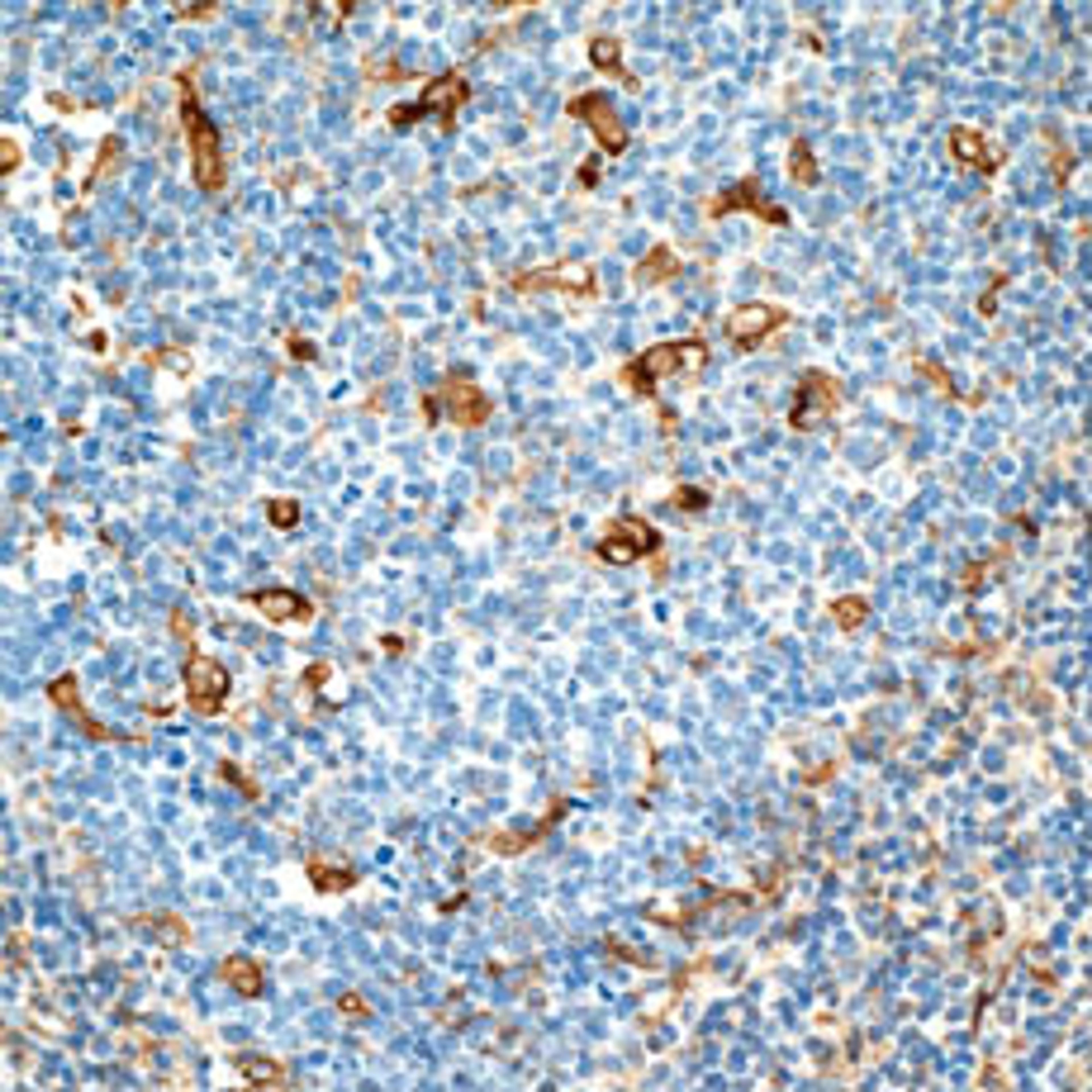 Detection of human Vimentin in FFPE tonsil by IHC.