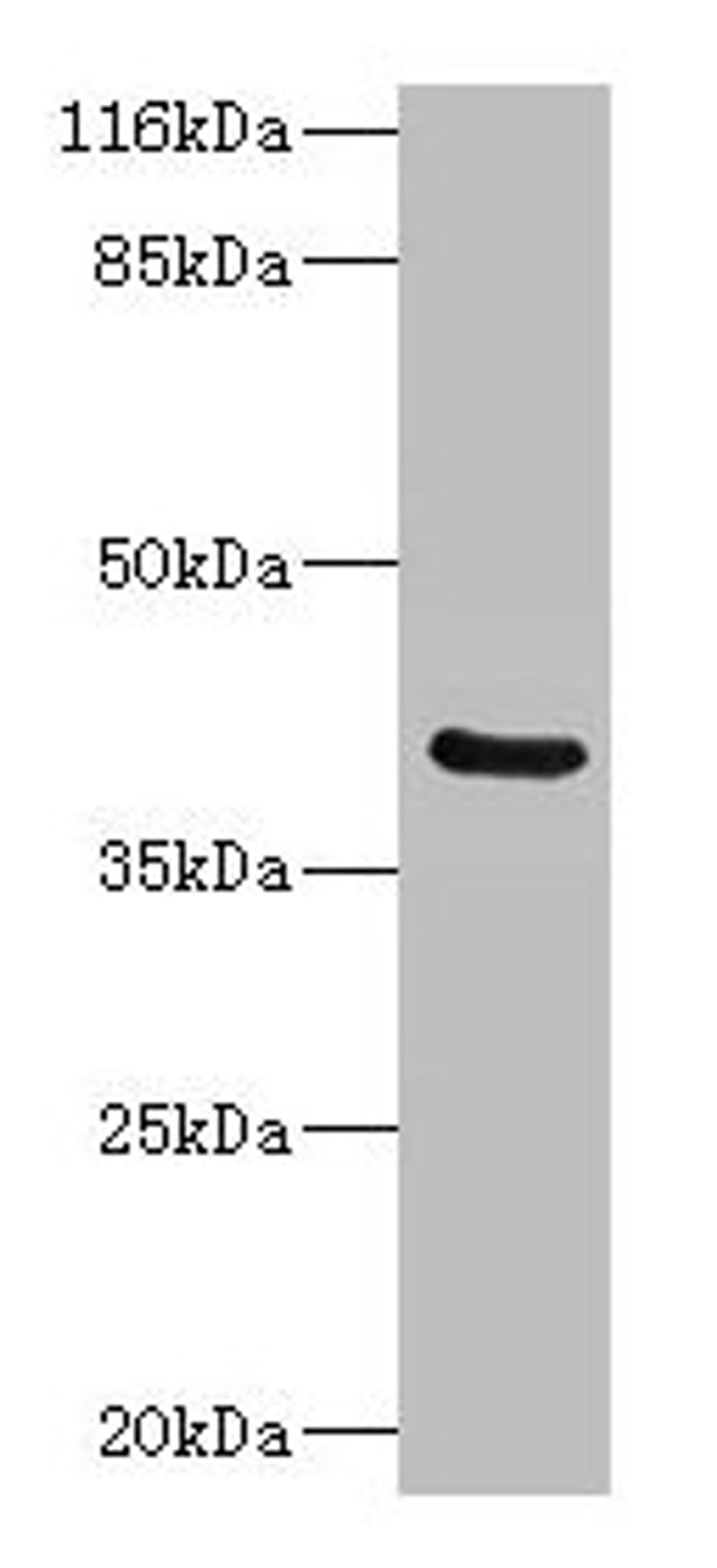 Western blot. All lanes: CA12 antibody at 2µg/ml + Mouse kidney tissue. Secondary. Goat polyclonal to rabbit IgG at 1/10000 dilution. Predicted band size: 40, 39 kDa. Observed band size: 40 kDa