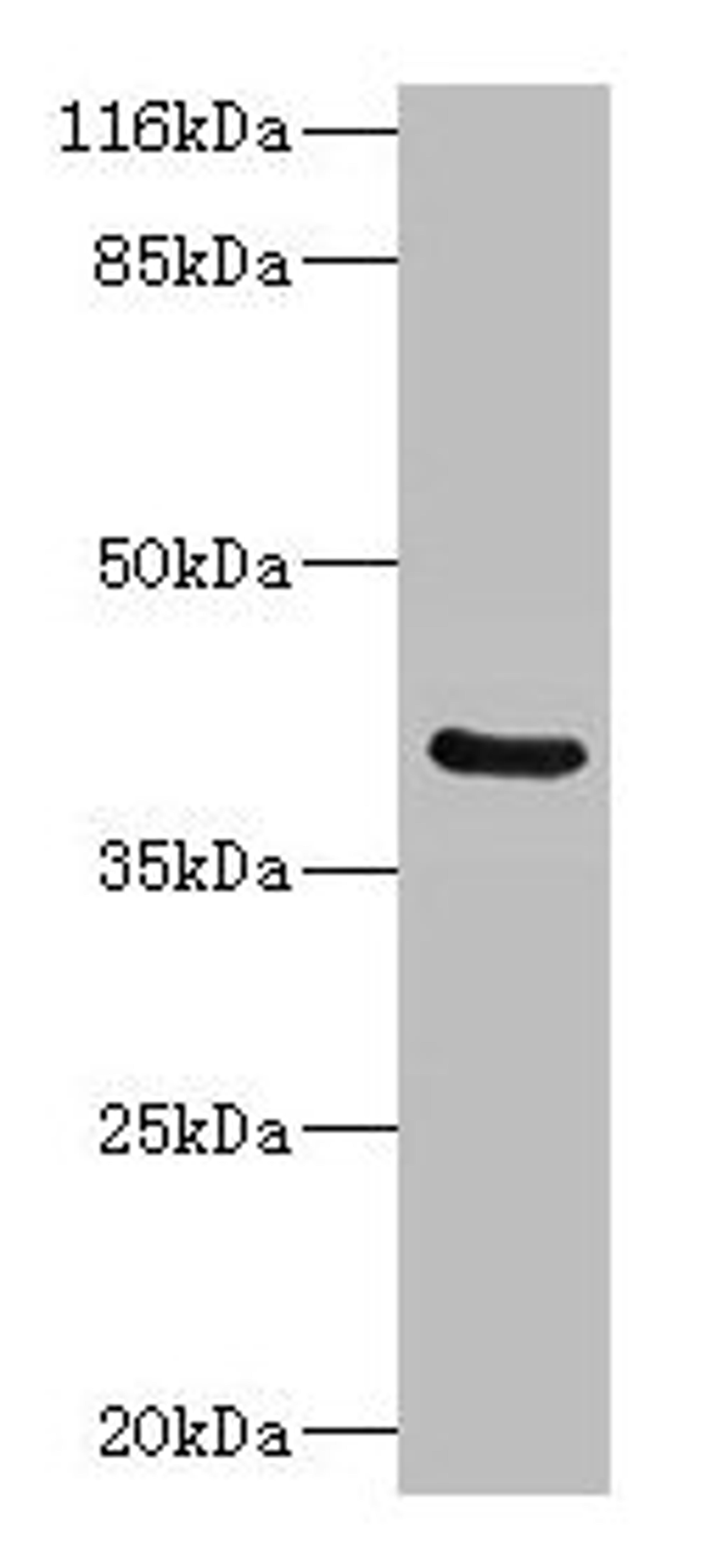 Western blot. All lanes: CA12 antibody at 2µg/ml + Mouse kidney tissue. Secondary. Goat polyclonal to rabbit IgG at 1/10000 dilution. Predicted band size: 40, 39 kDa. Observed band size: 40 kDa