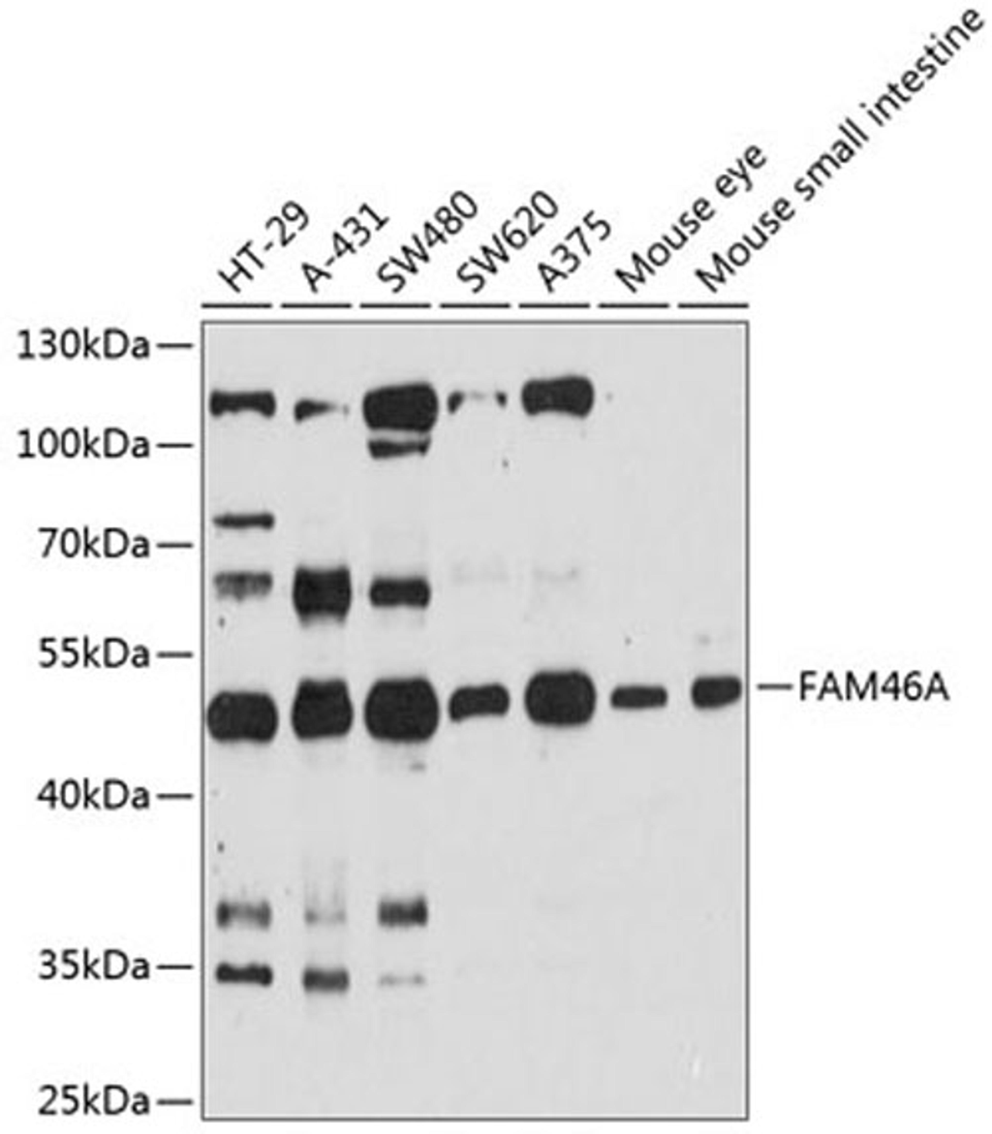 Western blot - FAM46A antibody (A12765)