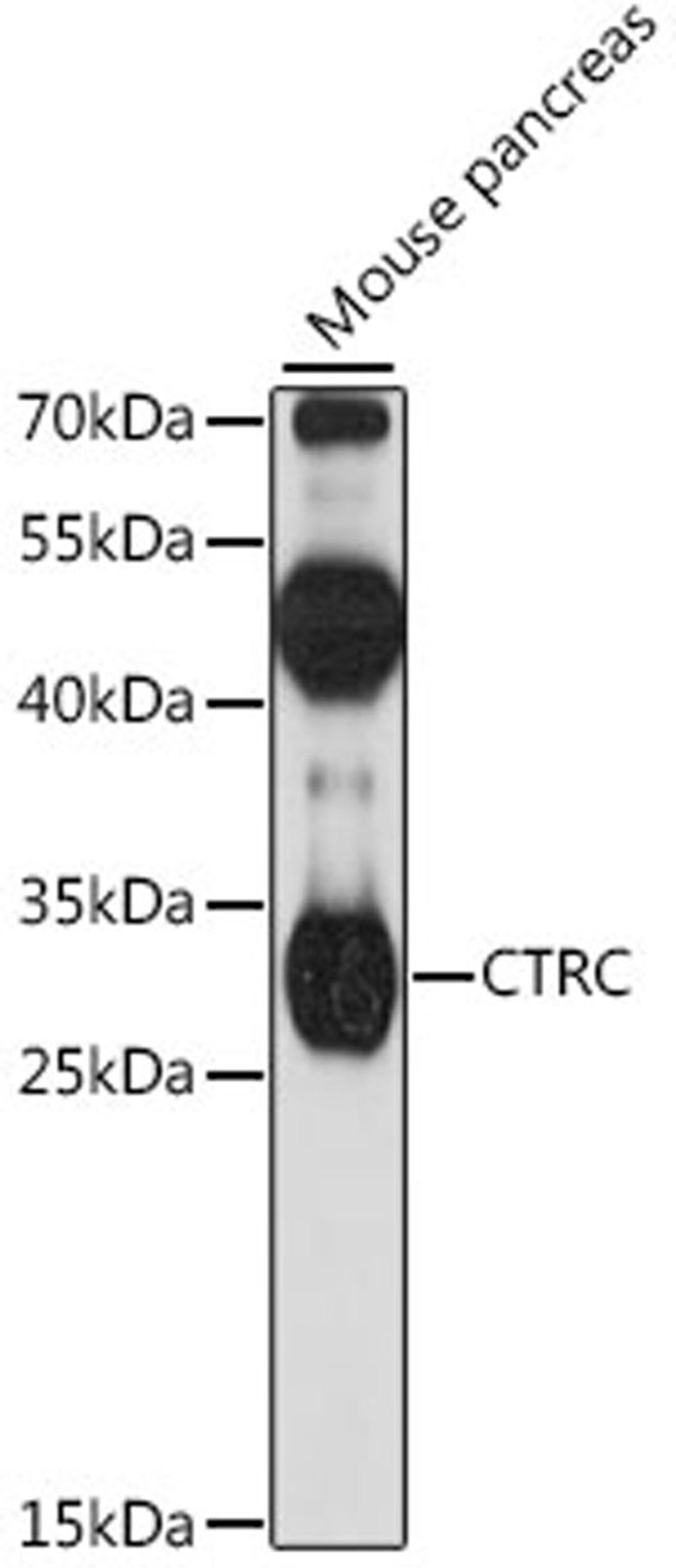 Western blot - CTRC antibody (A16104)