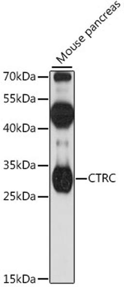 Western blot - CTRC antibody (A16104)