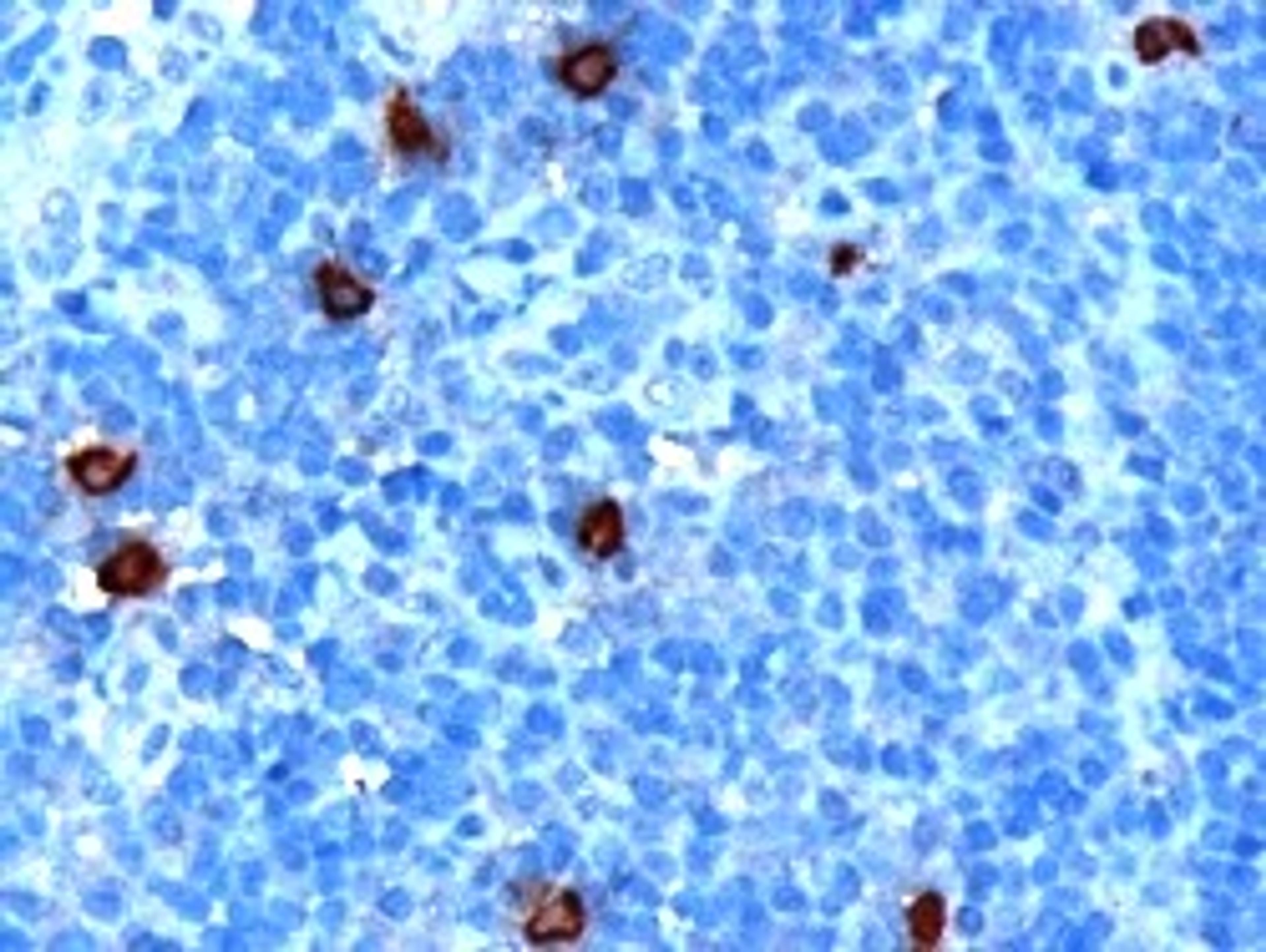 45-491 (1ug/ml) staining of paraffin embedded Human Tonsil. Microwaved antigen retrieval with citrate buffer pH6, HRP-staining.