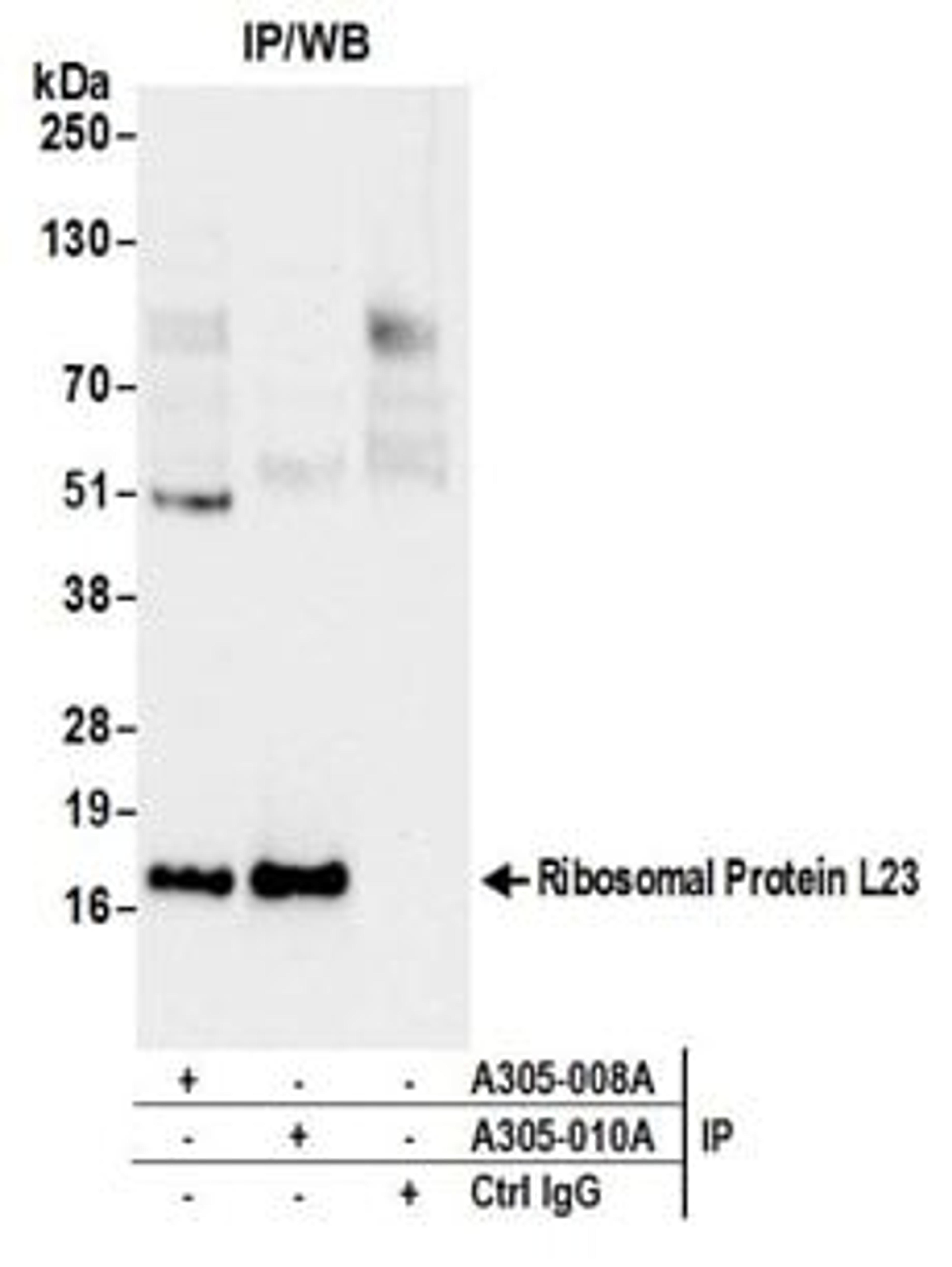 Detection of human Ribosomal Protein L23 by western blot of immunoprecipitates.