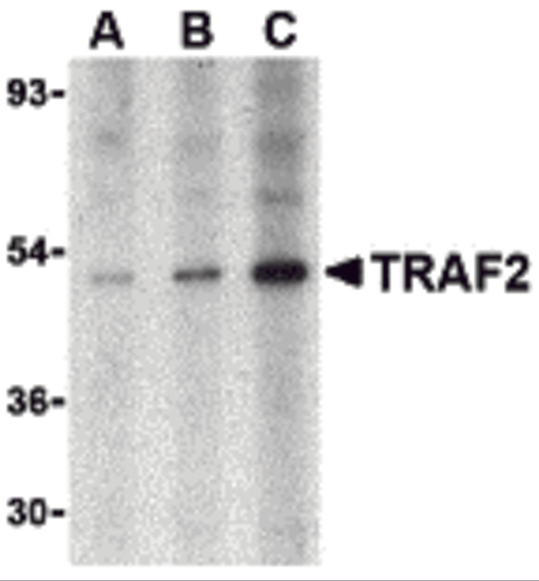Western blot analysis of TRAF2 in human liver tissue lysate with TRAF2 antibody at (A) 0.5, (B) 1 and (C) 2 μg/mL.