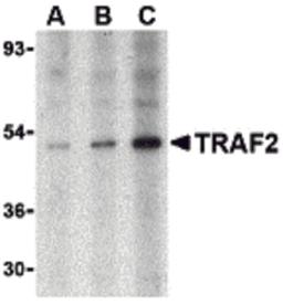 Western blot analysis of TRAF2 in human liver tissue lysate with TRAF2 antibody at (A) 0.5, (B) 1 and (C) 2 μg/mL.