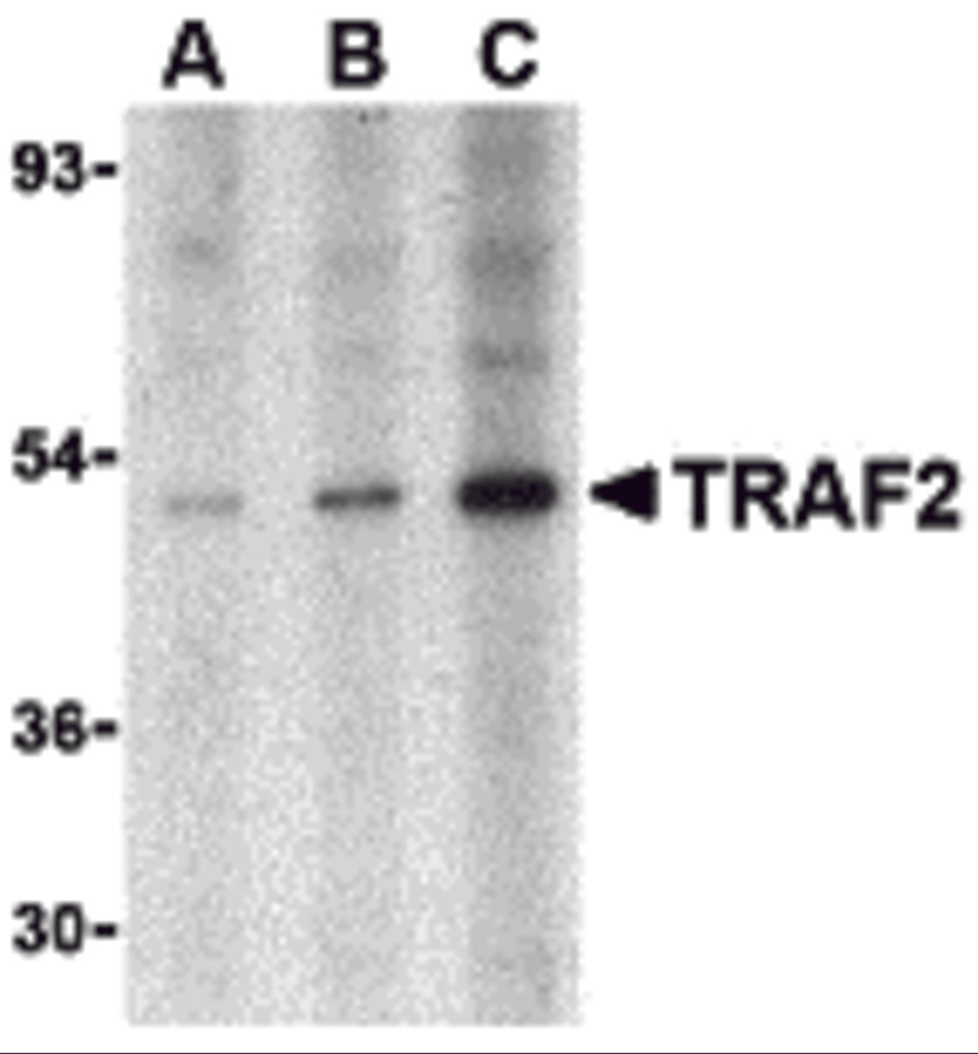 Western blot analysis of TRAF2 in human liver tissue lysate with TRAF2 antibody at (A) 0.5, (B) 1 and (C) 2 μg/mL.