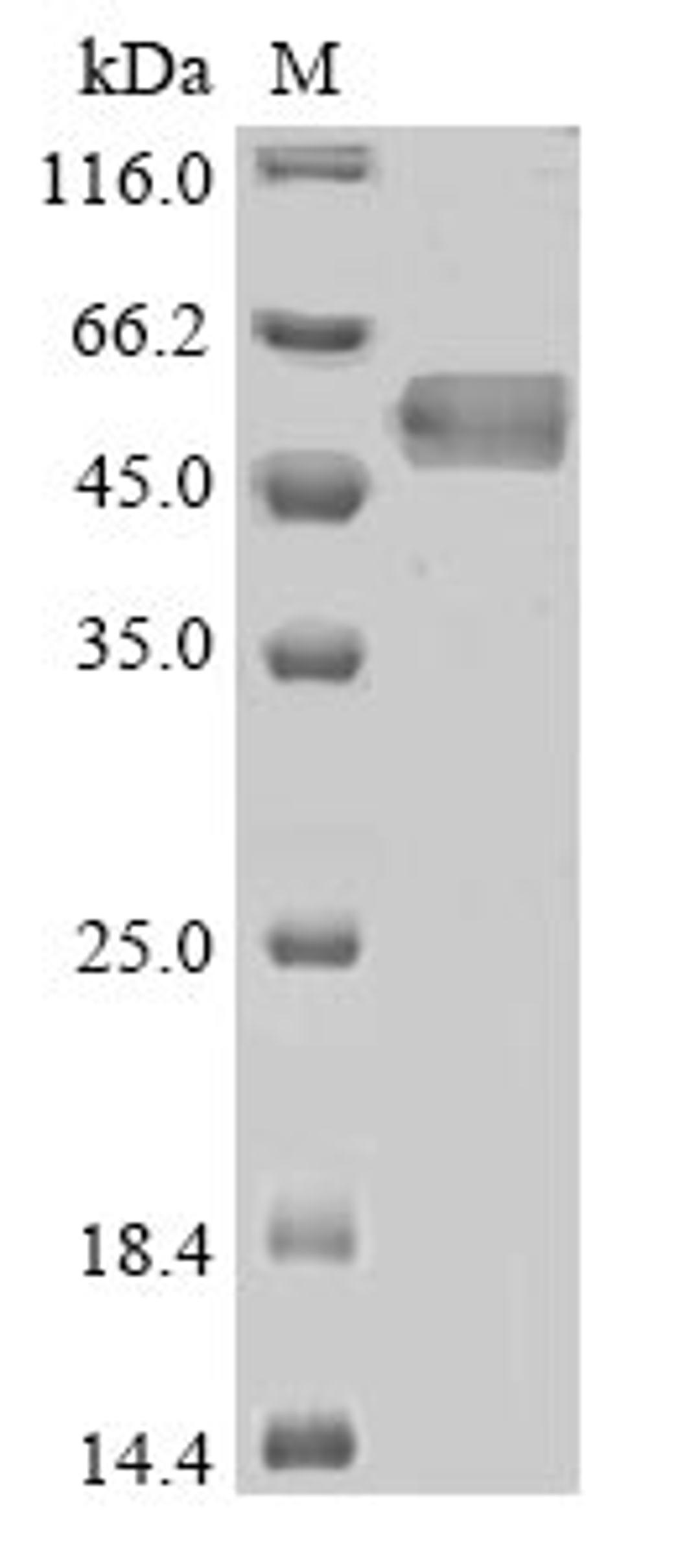 (Tris-Glycine gel) Discontinuous SDS-PAGE (reduced) with 5% enrichment gel and 15% separation gel.