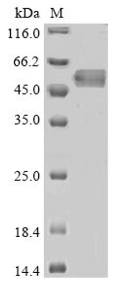 (Tris-Glycine gel) Discontinuous SDS-PAGE (reduced) with 5% enrichment gel and 15% separation gel.