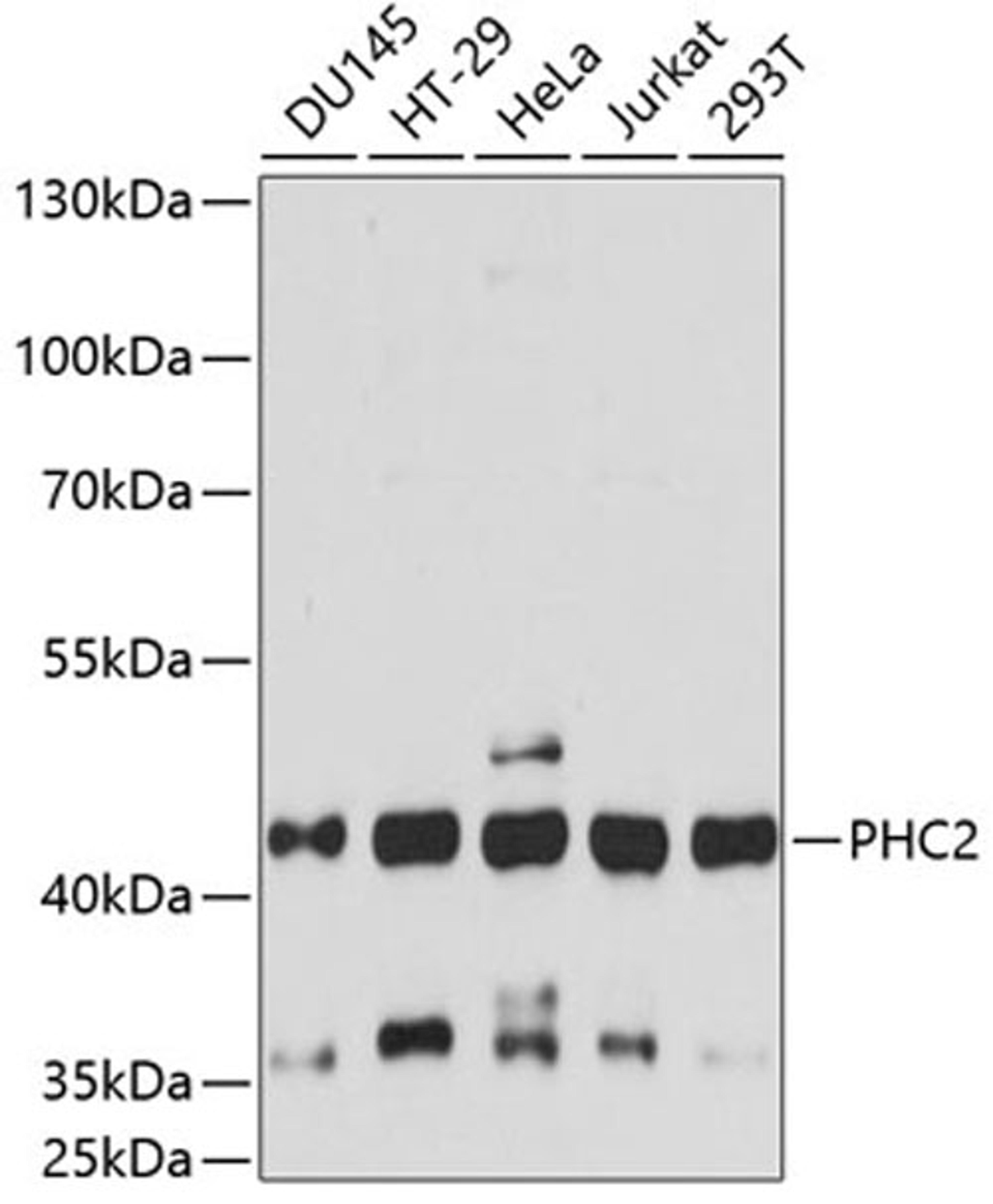 Western blot - PHC2 antibody (A14610)