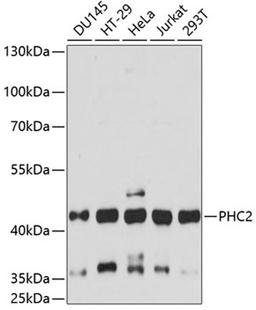 Western blot - PHC2 antibody (A14610)