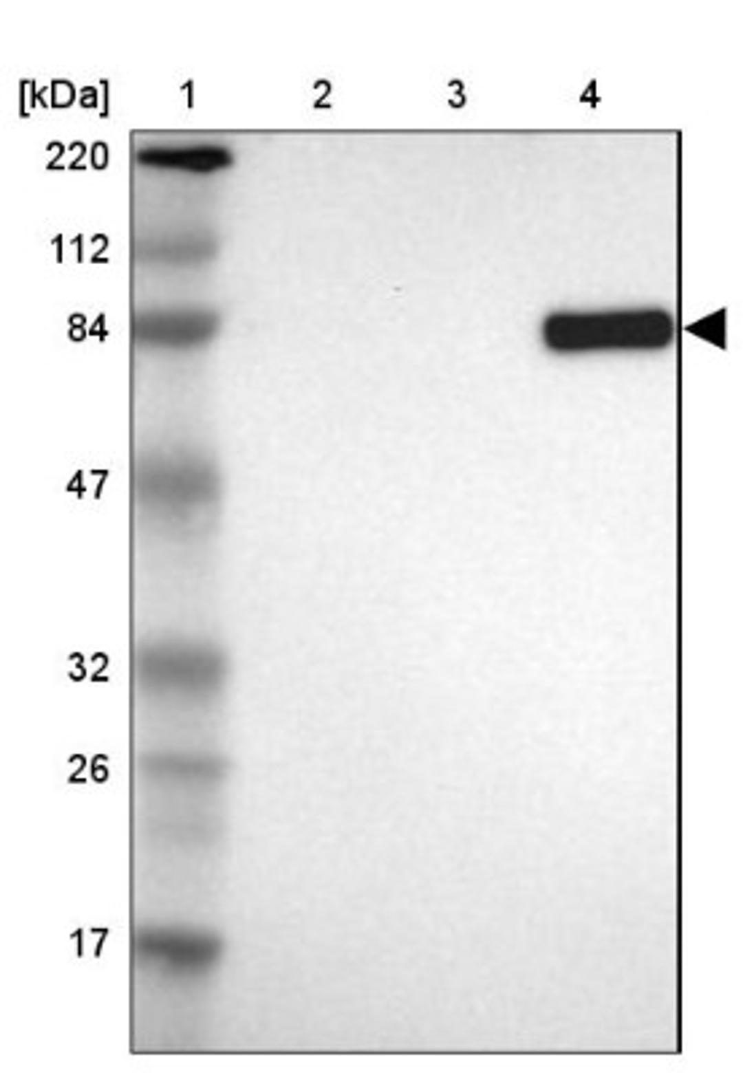 Western Blot: MTIF2 Antibody [NBP1-81609] - Lane 1: Marker [kDa] 220, 112, 84, 47, 32, 26, 17<br/>Lane 2: Human cell line RT-4<br/>Lane 3: Human cell line U-251MG sp<br/>Lane 4: Human plasma (IgG/HSA depleted)