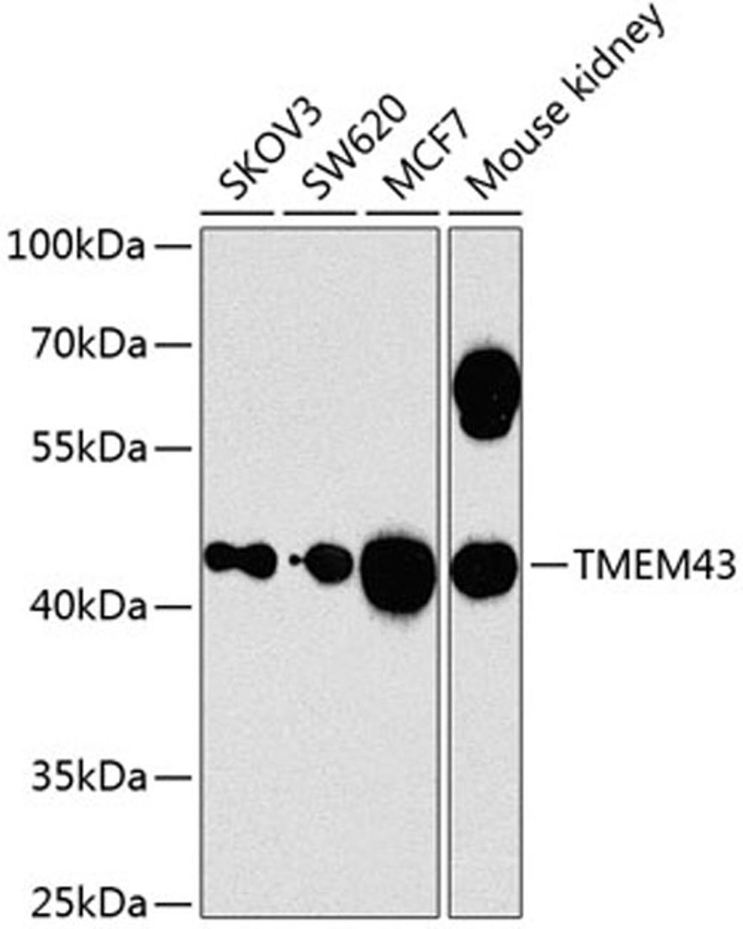 Western blot - TMEM43 antibody (A8509)