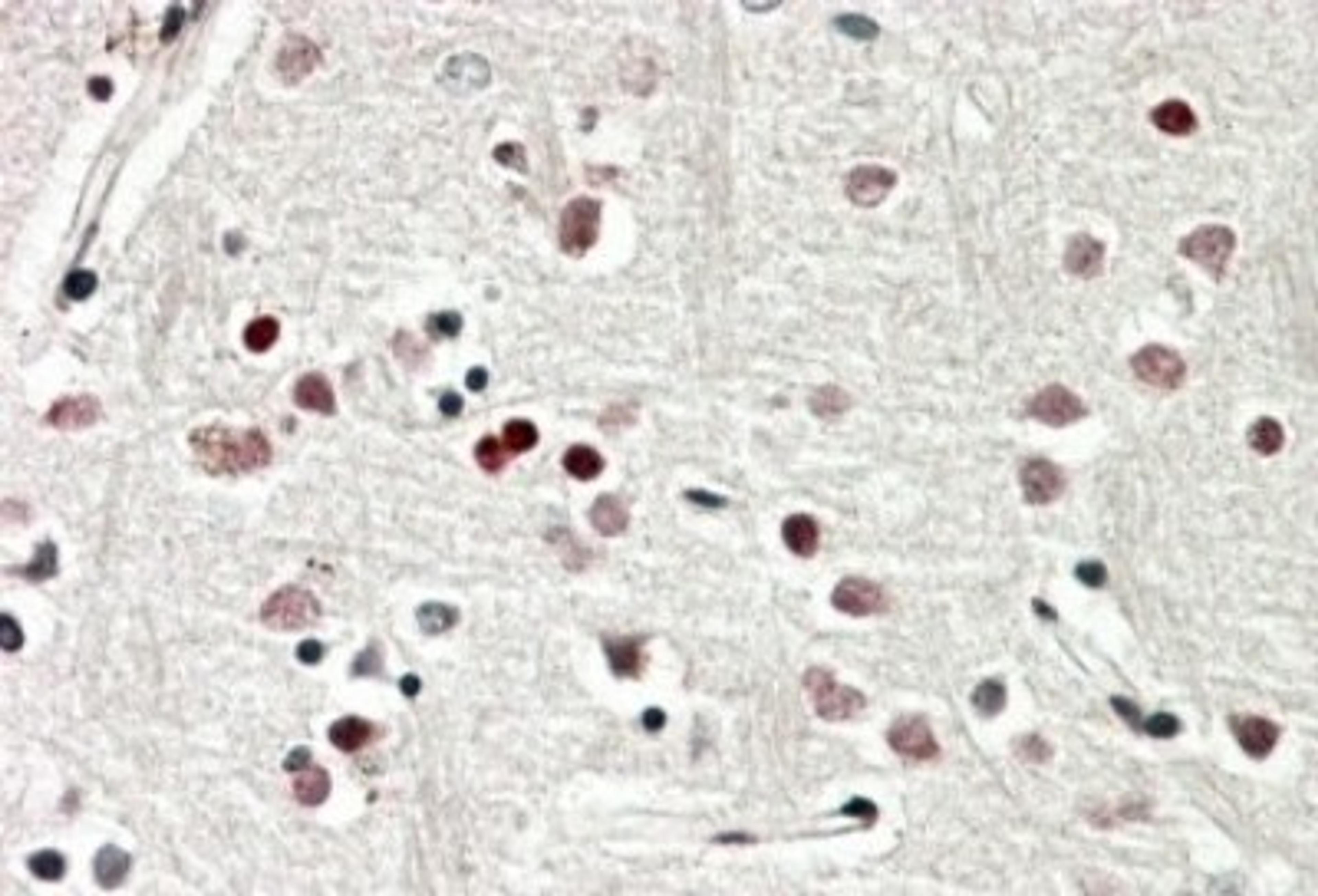 Immunohistochemistry-Paraffin: SOX3 Antibody [NBP1-52043] - (3.8ug/ml) staining of paraffin embedded Human Cerebral Cortex. Steamed antigen retrieval with citrate buffer pH 6, AP-staining.