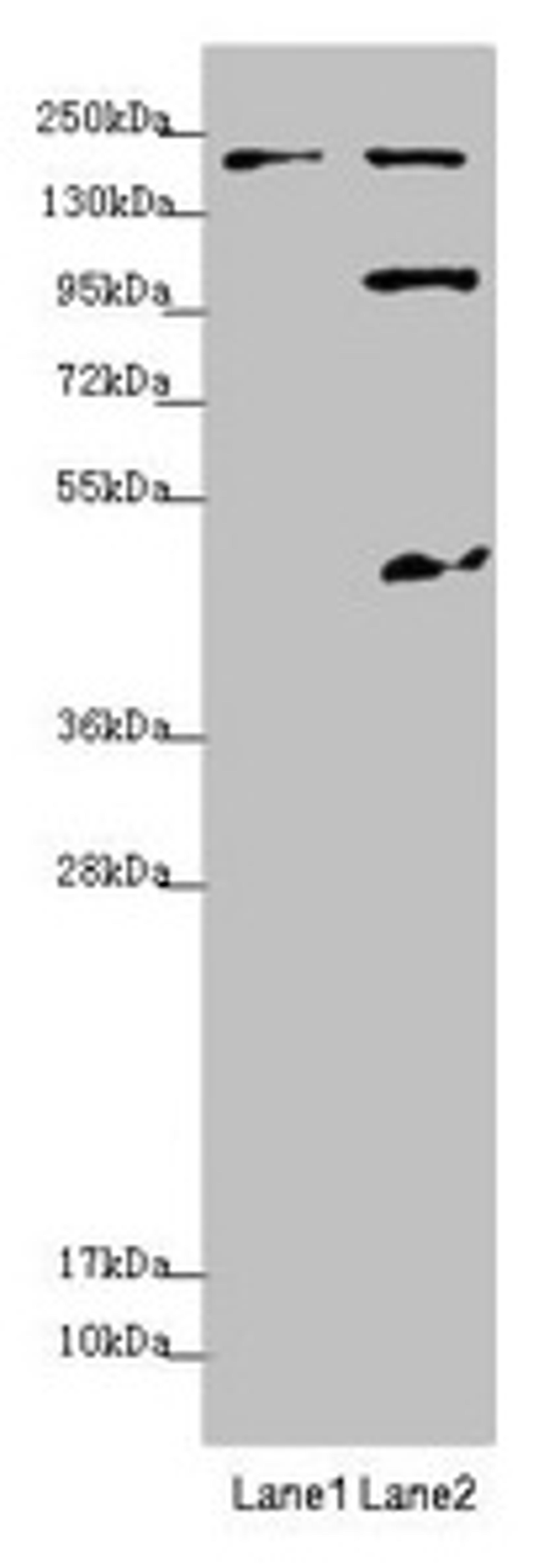 Western blot. All lanes: MYO5B antibody at 1.7µg/ml. Lane 1: Jurkat whole cell lysate. Lane 2: HepG2 whole cell lysate. Secondary. Goat polyclonal to rabbit IgG at 1/10000 dilution. Predicted band size: 214, 112, 48 kDa. Observed band size: 214, 112, 48 kDa