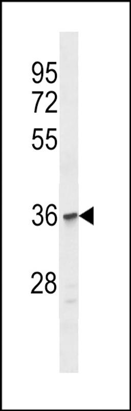 Western blot analysis in Jurkat cell line lysates (35ug/lane).