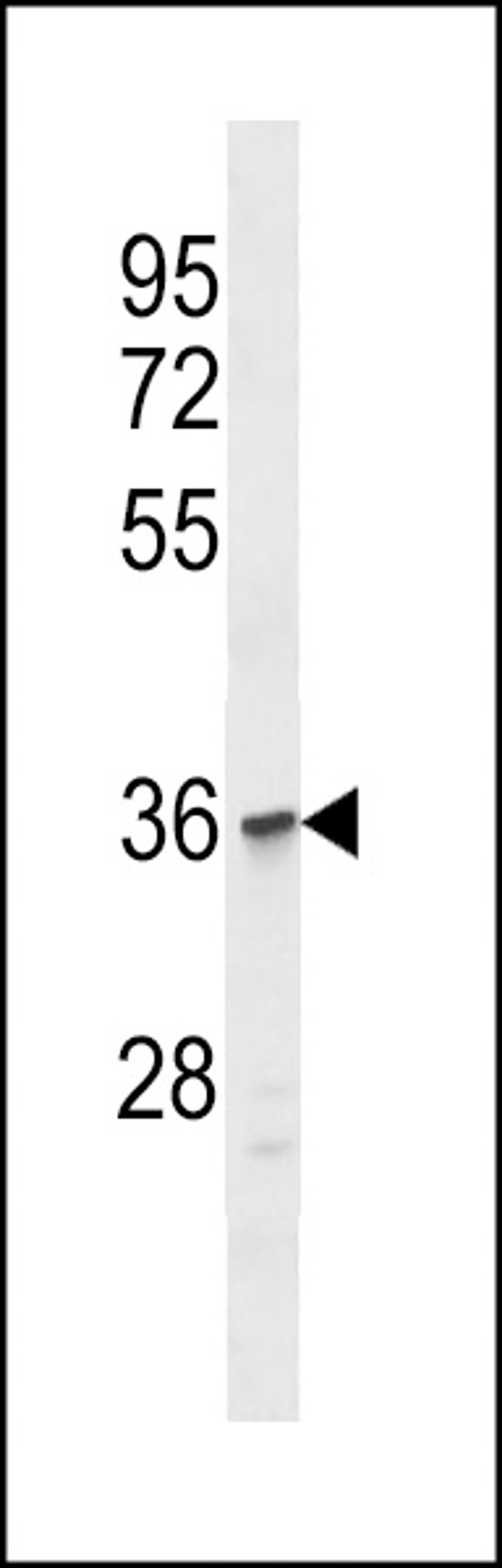 Western blot analysis in Jurkat cell line lysates (35ug/lane).