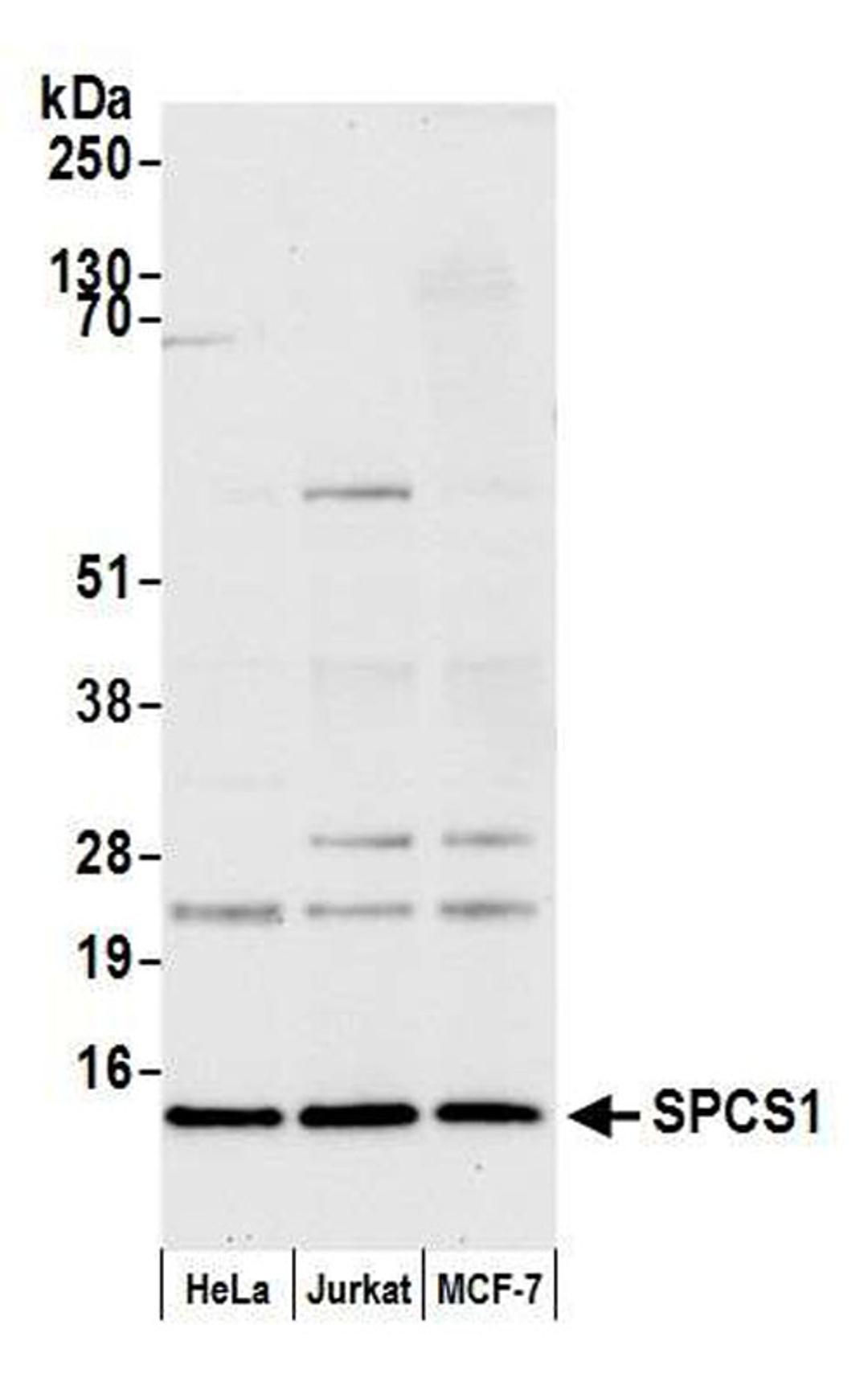 Detection of human SPCS1 by WB.