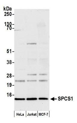 Detection of human SPCS1 by WB.