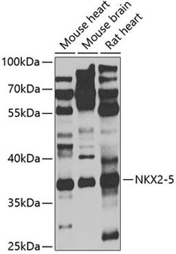 Western blot - NKX2-5 antibody (A5651)