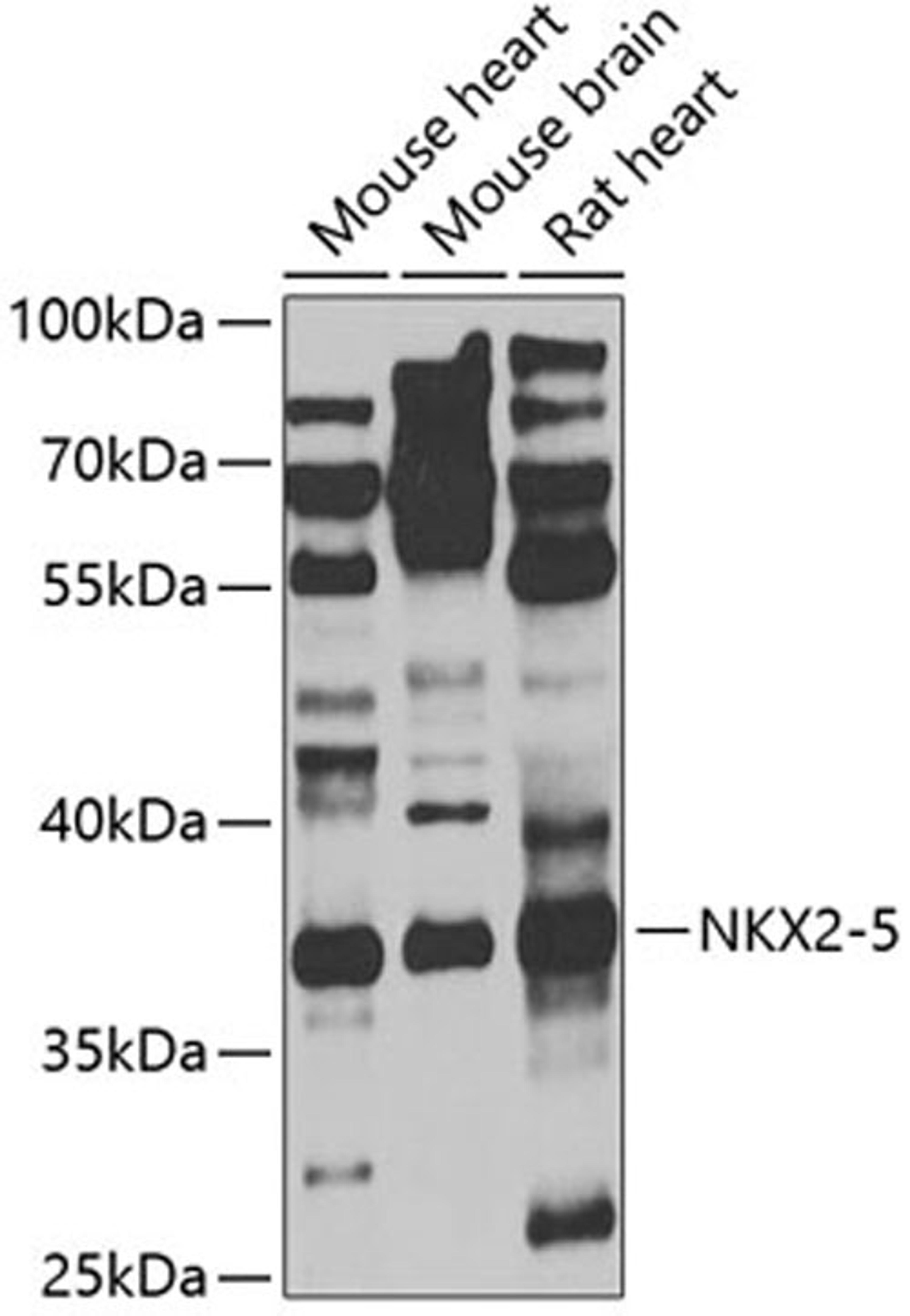 Western blot - NKX2-5 antibody (A5651)