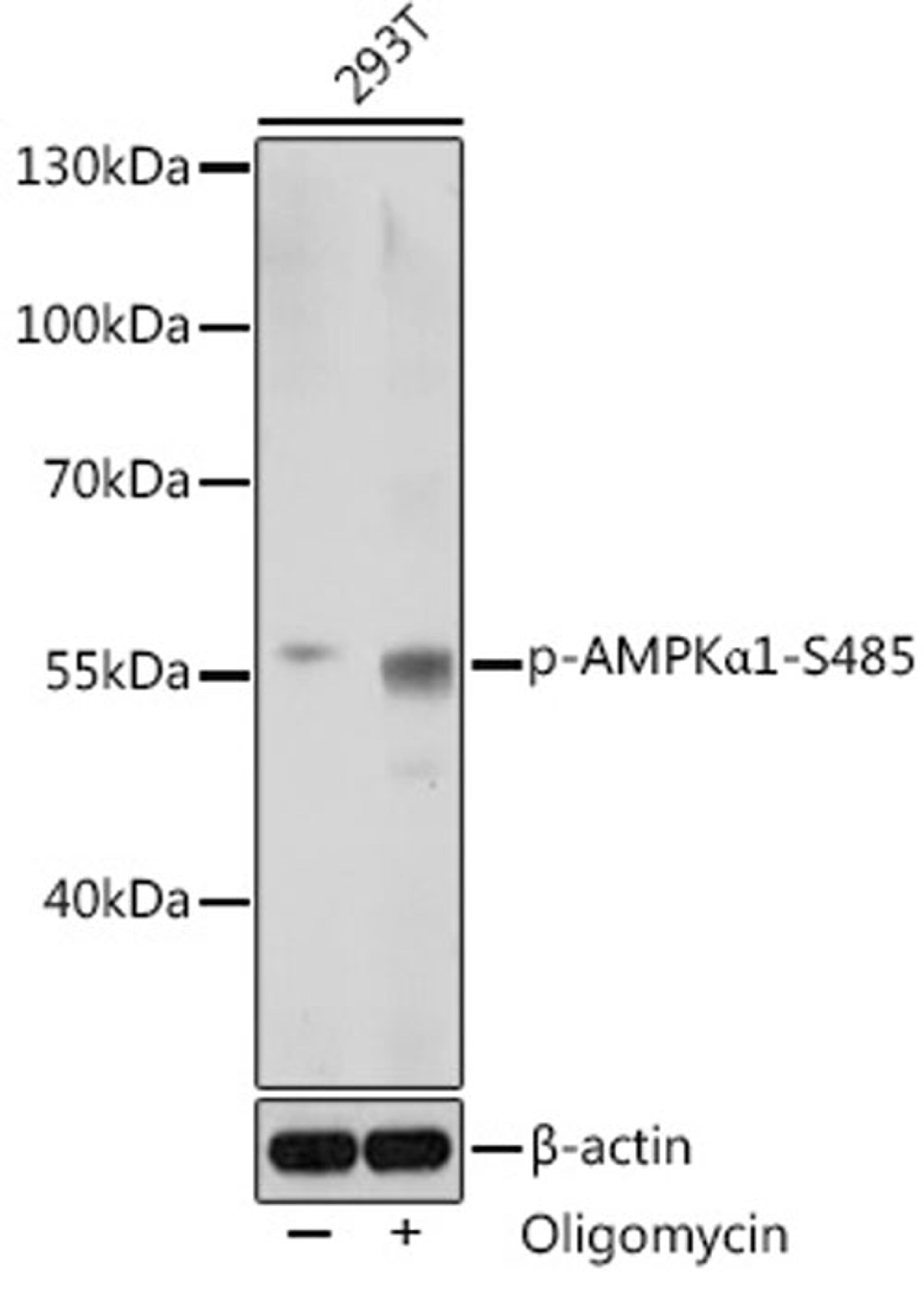 Western blot - Phospho-AMPKa1-S485 antibody (AP0871)