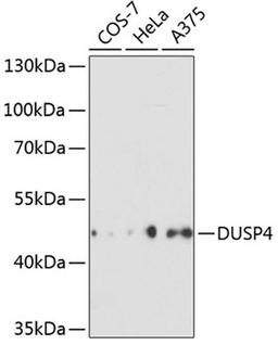 Western blot - DUSP4 antibody (A2726)