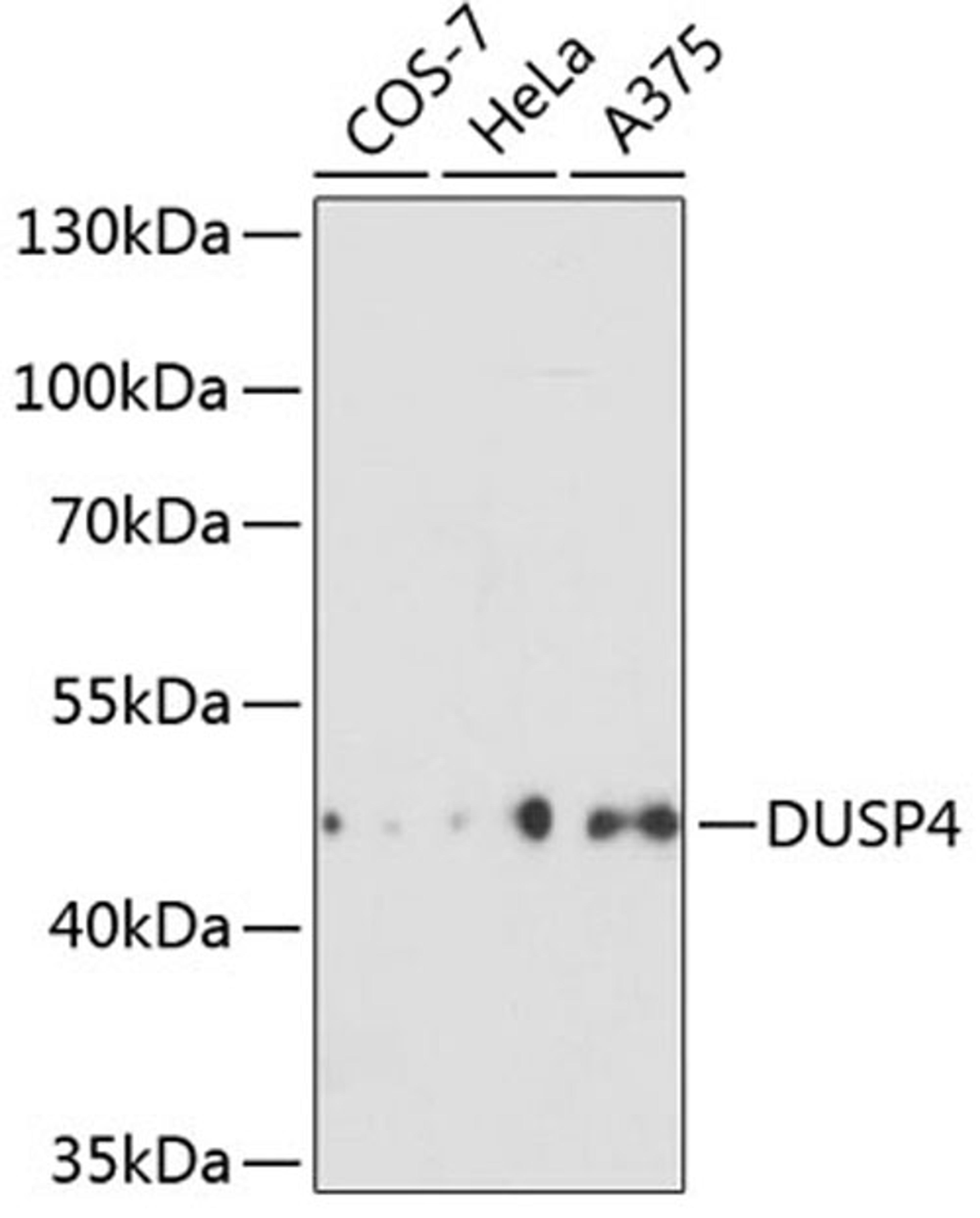 Western blot - DUSP4 antibody (A2726)