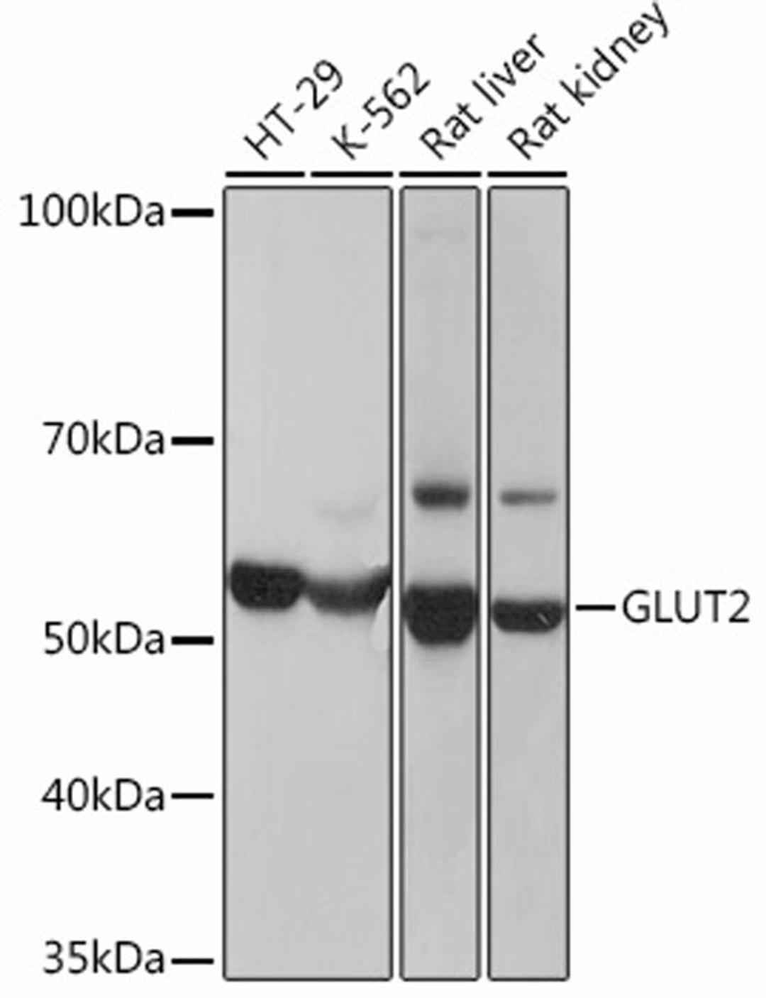 Western blot - GLUT2 Rabbit mAb (A12307)