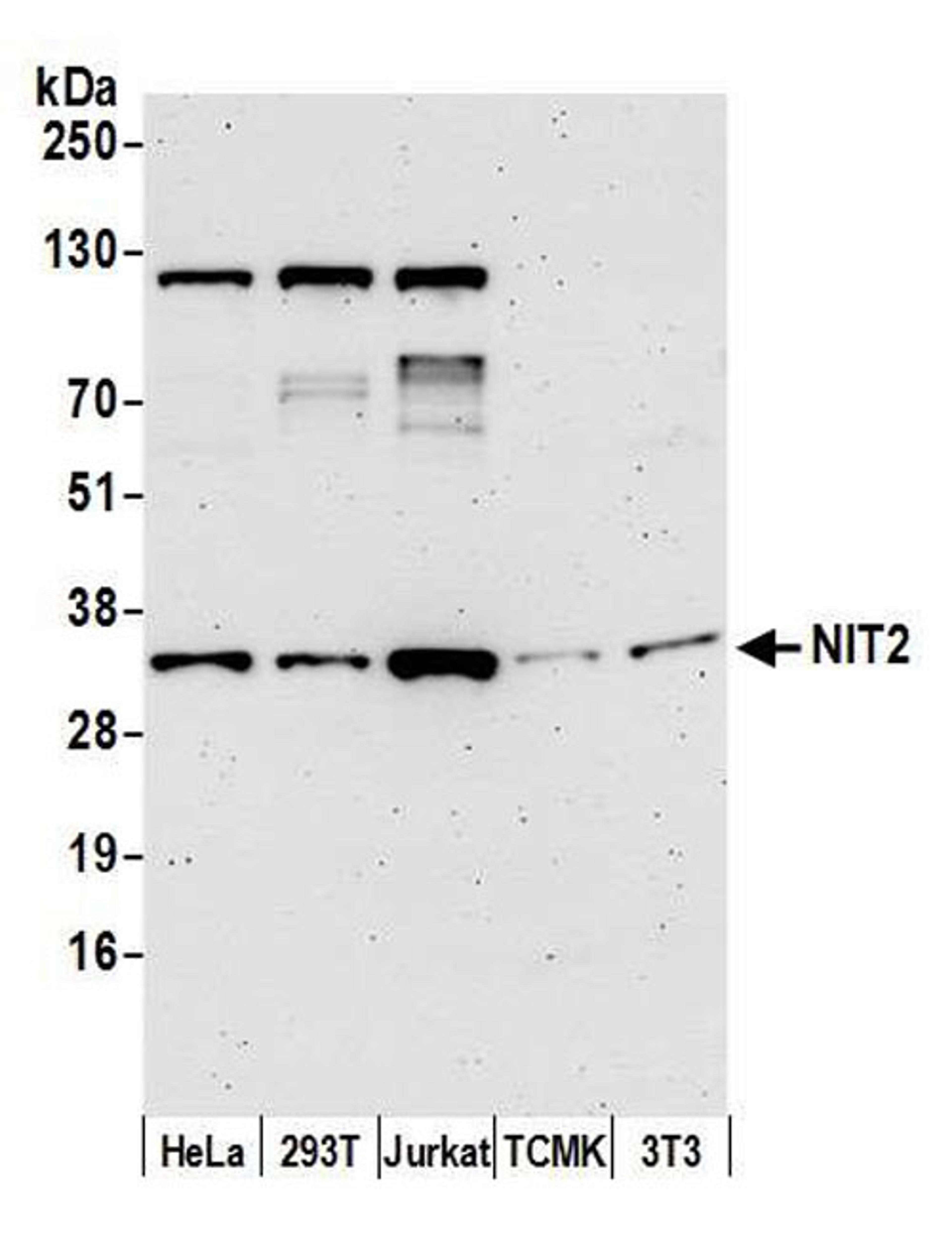 Detection of human and mouse NIT2 by WB.