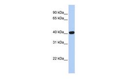 Antibody used in WB on Human Brain at 0.2-1 ug/ml.