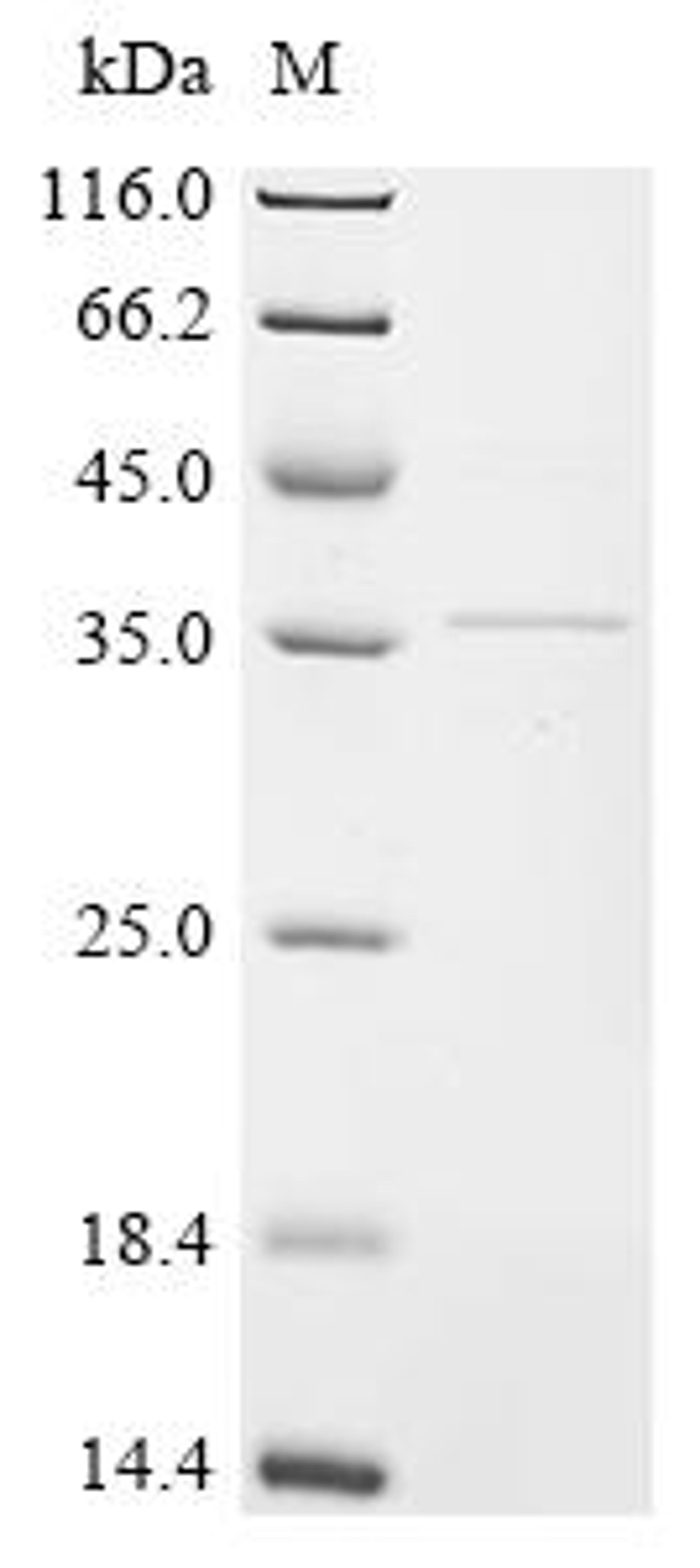 (Tris-Glycine gel) Discontinuous SDS-PAGE (reduced) with 5% enrichment gel and 15% separation gel.
