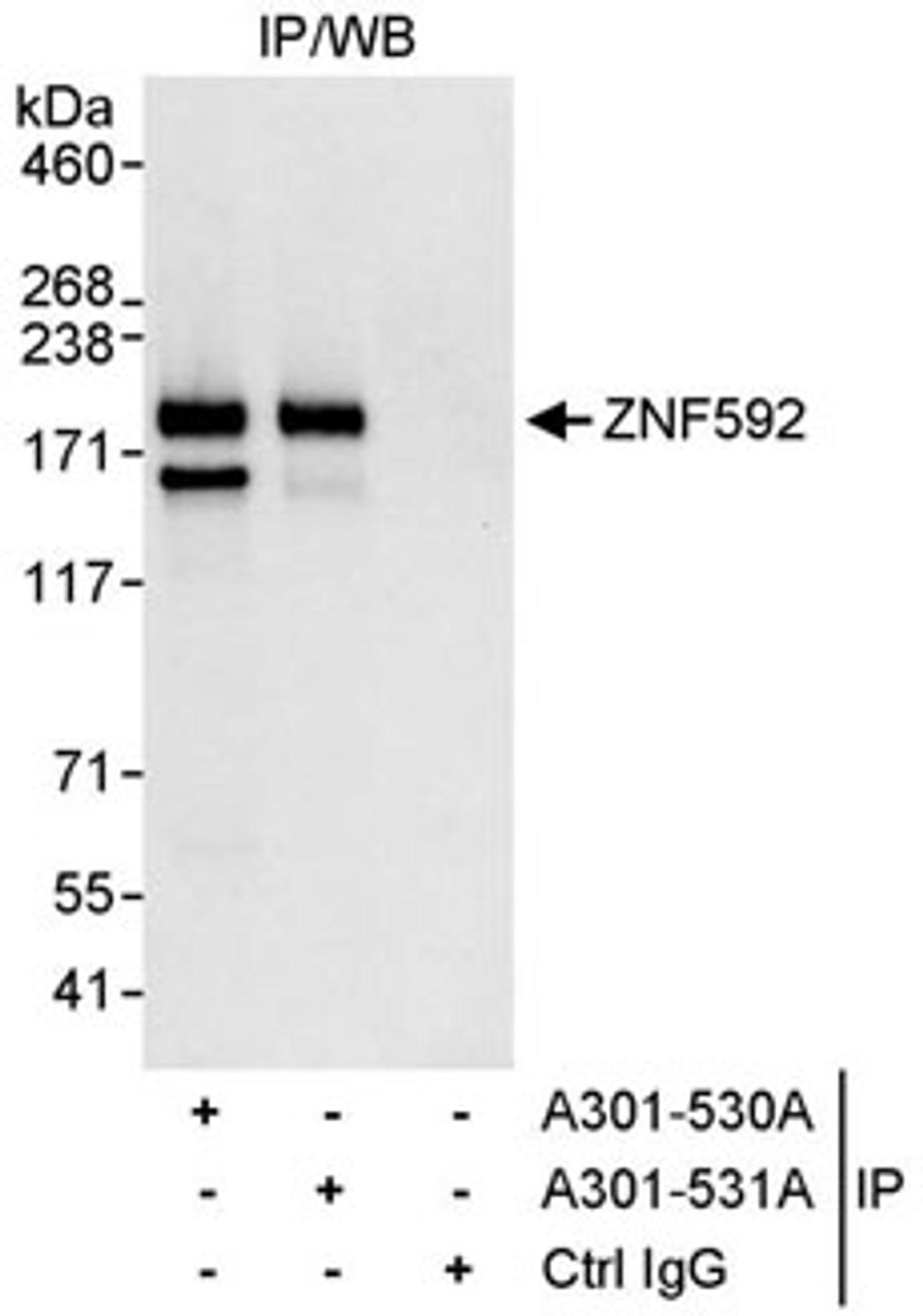 Detection of human ZNF592 by western blot of immunoprecipitates.