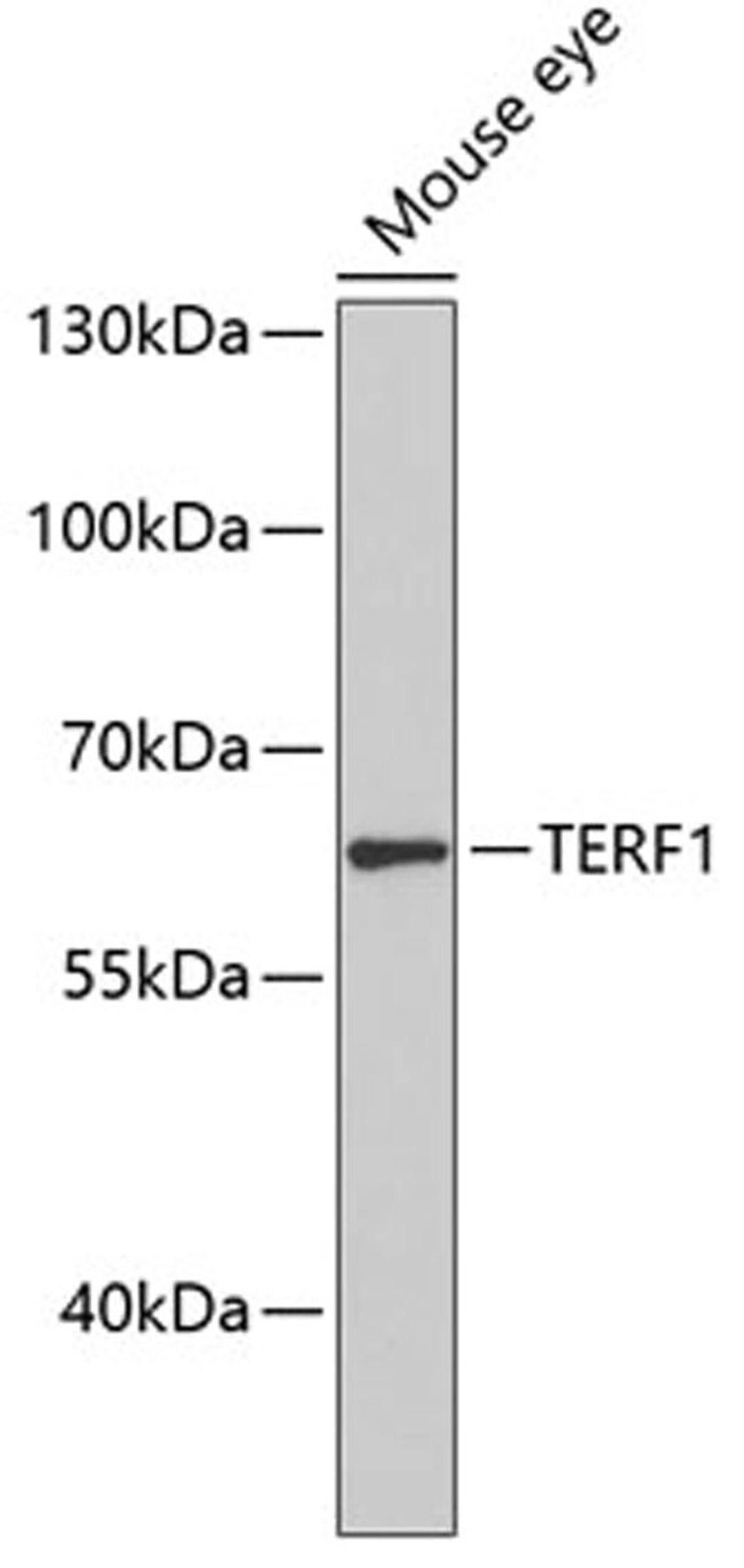 Western blot - TERF1 antibody (A0137)