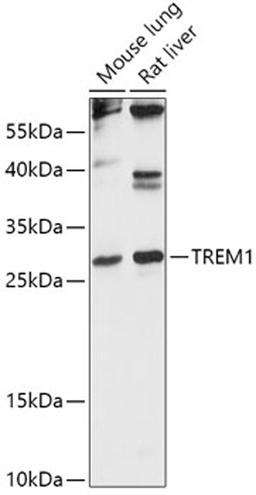 Western blot - TREM1 antibody (A16535)