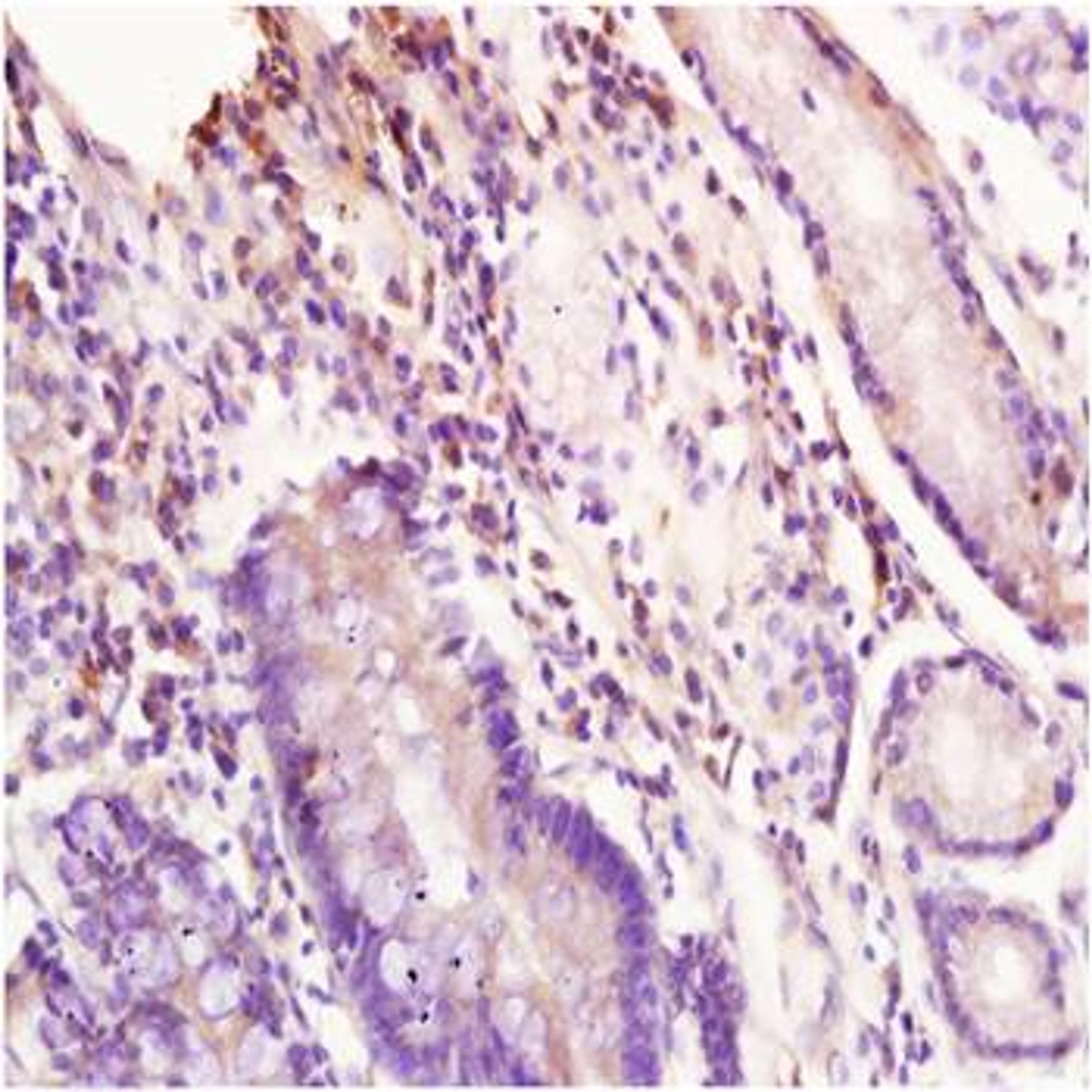 Paraffin-embedded human stomach tissue fixed with 4% paraformaldehyde. Antigen retrieval by boiling with citrate buffer. Blocking buffer is goat serum (37 degrees for 20 min.). Inhibin beta A antibody at 1:200 dilution with overnight incubation at 4 degre