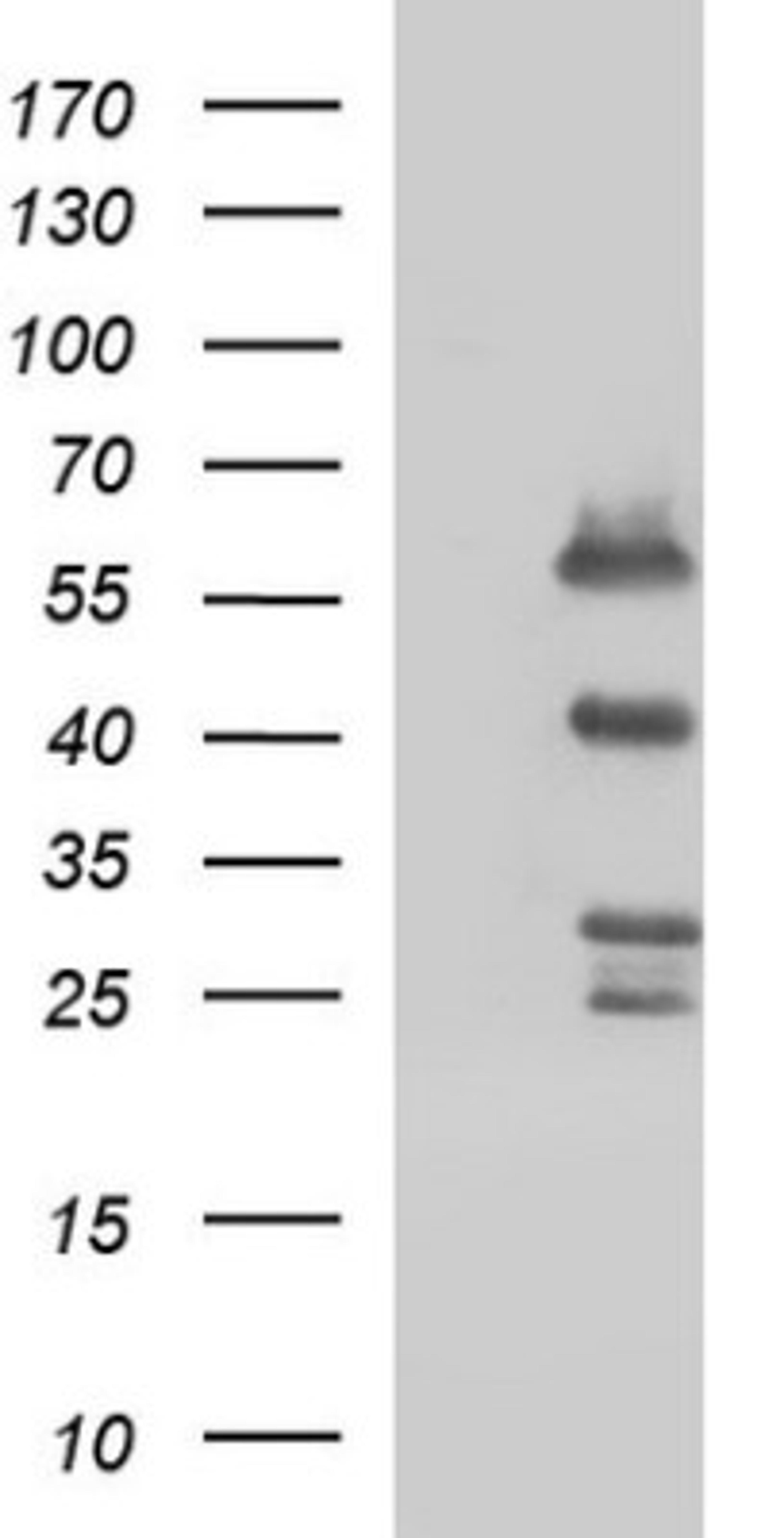 Western Blot: Smad1 Antibody (1C5) [NBP2-45869] - Analysis of HEK293T cells were transfected with the pCMV6-ENTRY control (Left lane) or pCMV6-ENTRY SMAD1.