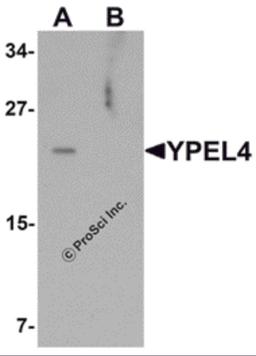 Western blot analysis of YPEL4 in SW480 cell lysate with YPEL4 antibody at 1 μg/mL in (A) the absence and (B) the presence of blocking peptide.