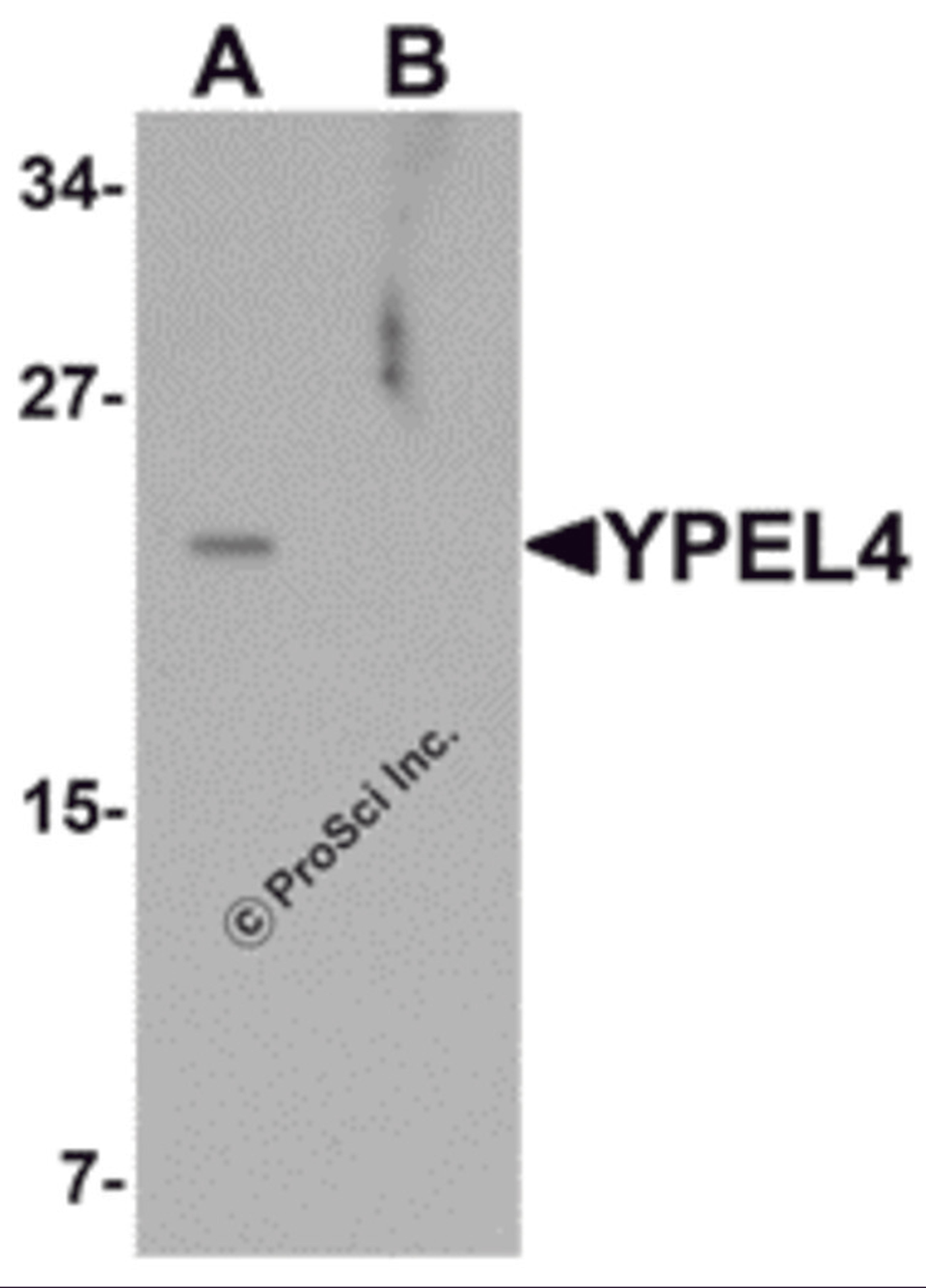 Western blot analysis of YPEL4 in SW480 cell lysate with YPEL4 antibody at 1 μg/mL in (A) the absence and (B) the presence of blocking peptide.